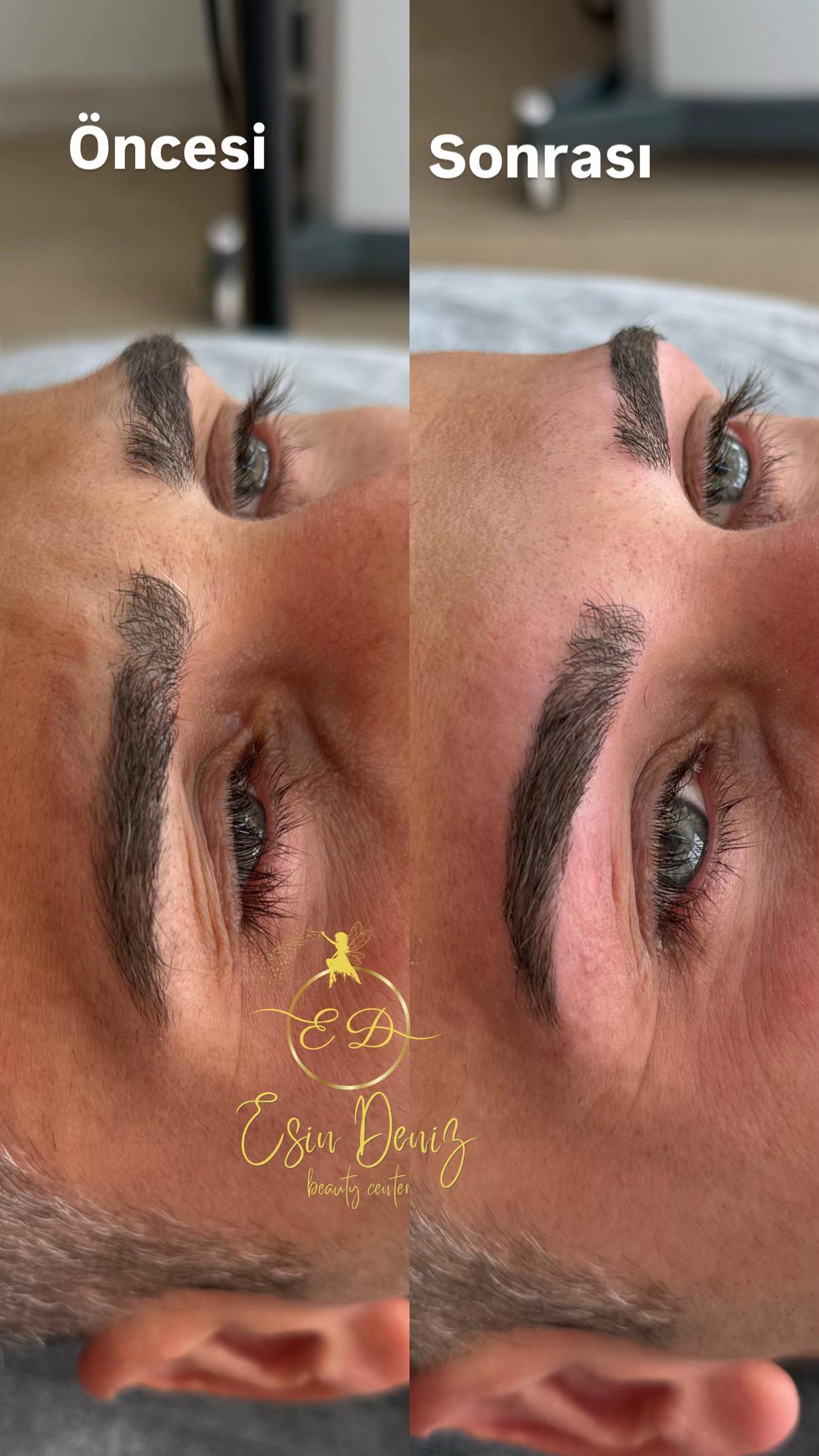 @Esin Deniz Beauty center