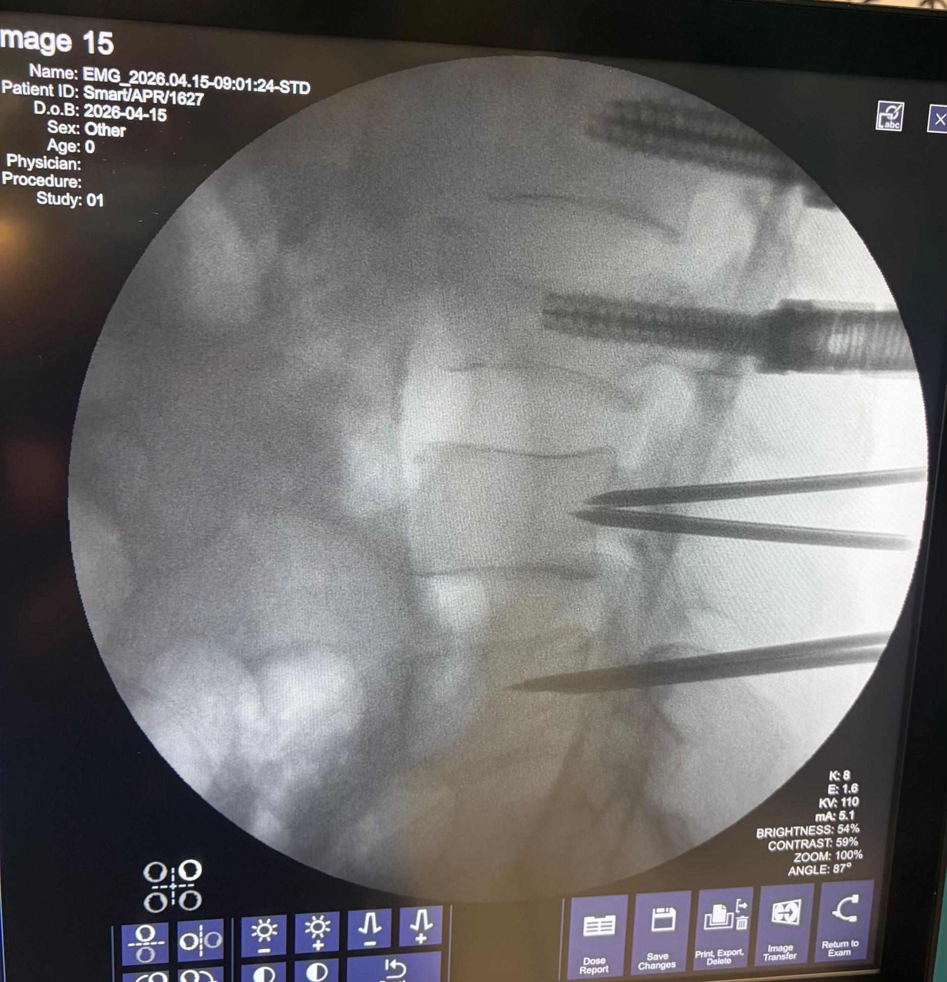 @Orthopedic_Surgeon_Arbind