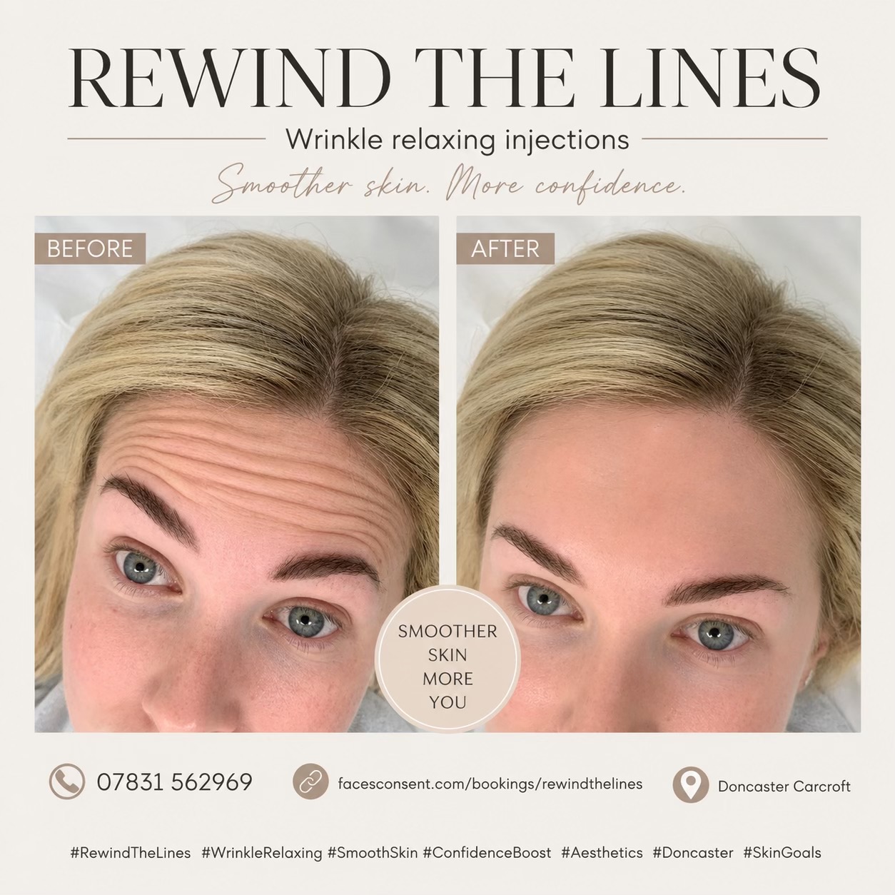 @Rewind the lines