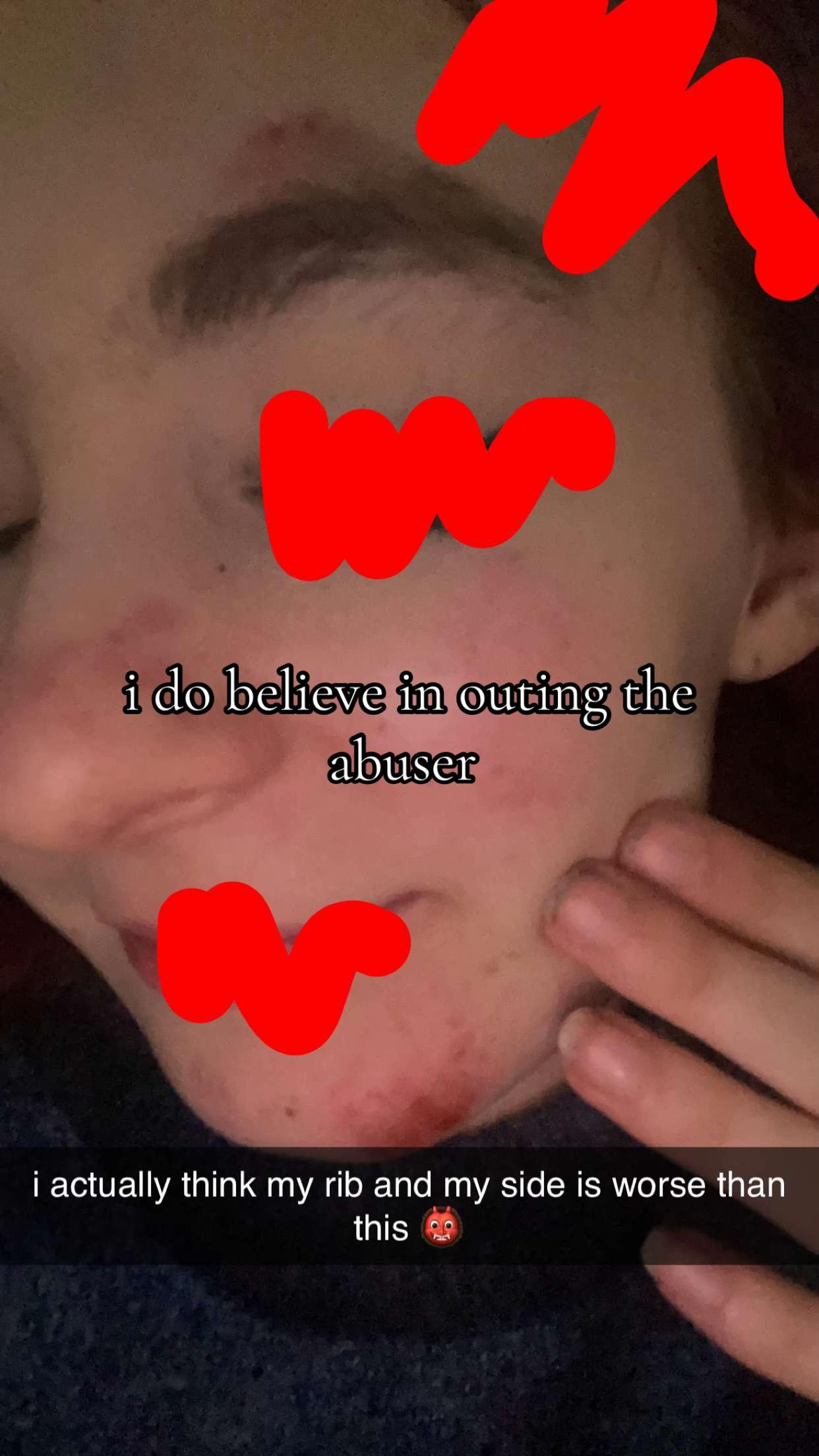 @𝔏𝔞𝔲𝔯𝔢𝔫-𝔐𝔦𝔠𝔥𝔢𝔩𝔩𝔢