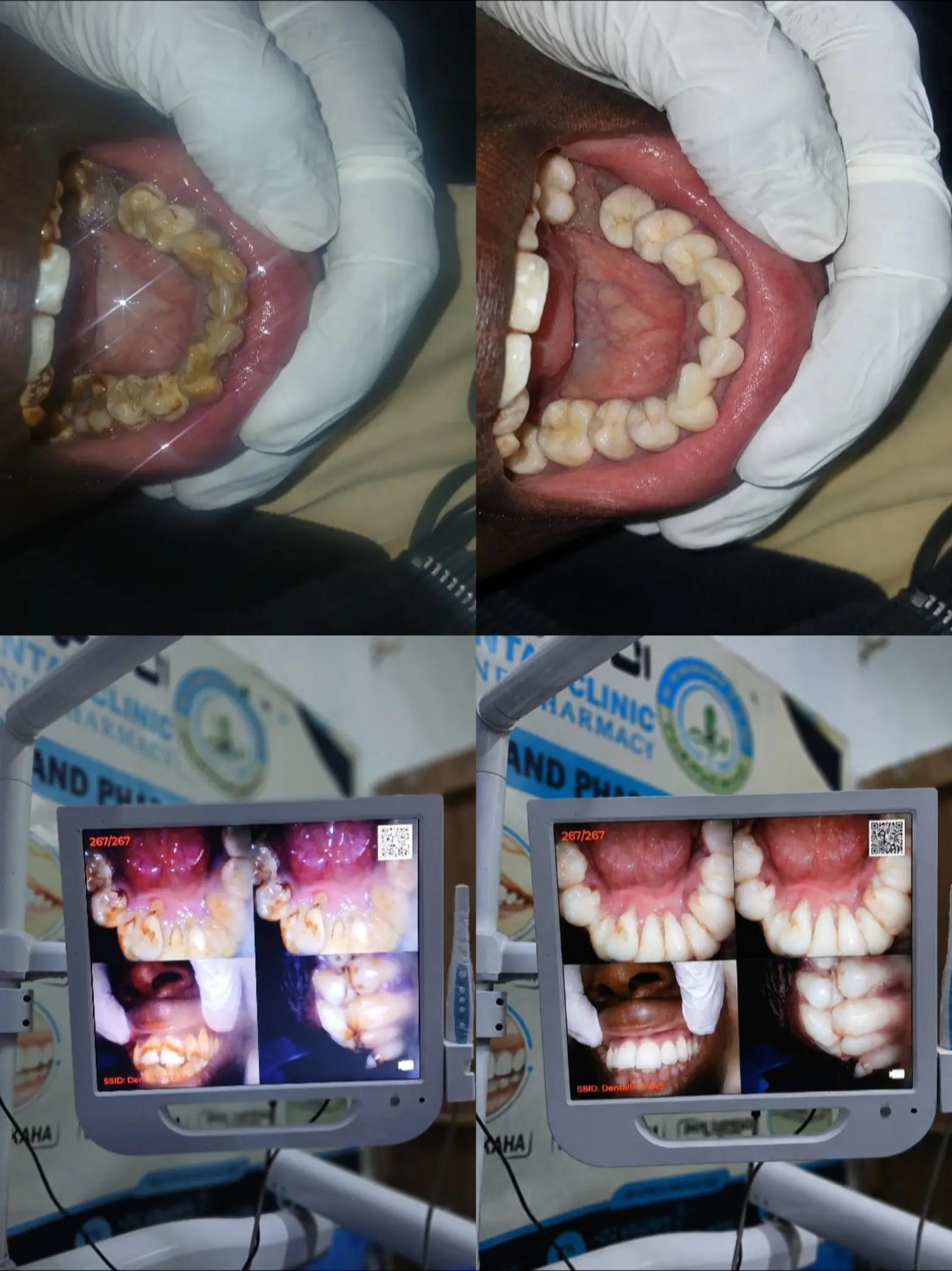 @Dr.Naasir🦷🩵🩺