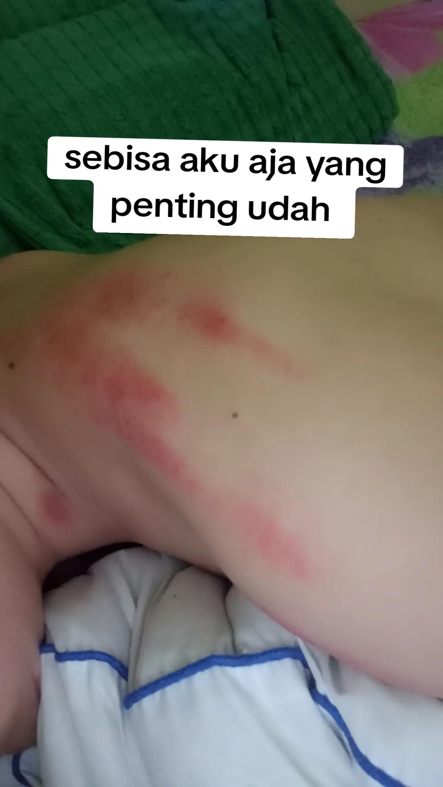 @ayuBERAU🥰