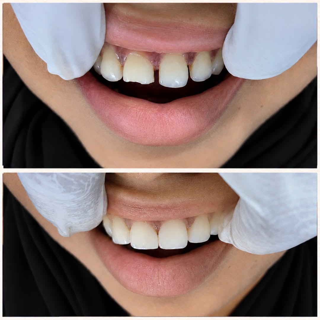 @Tech Dental