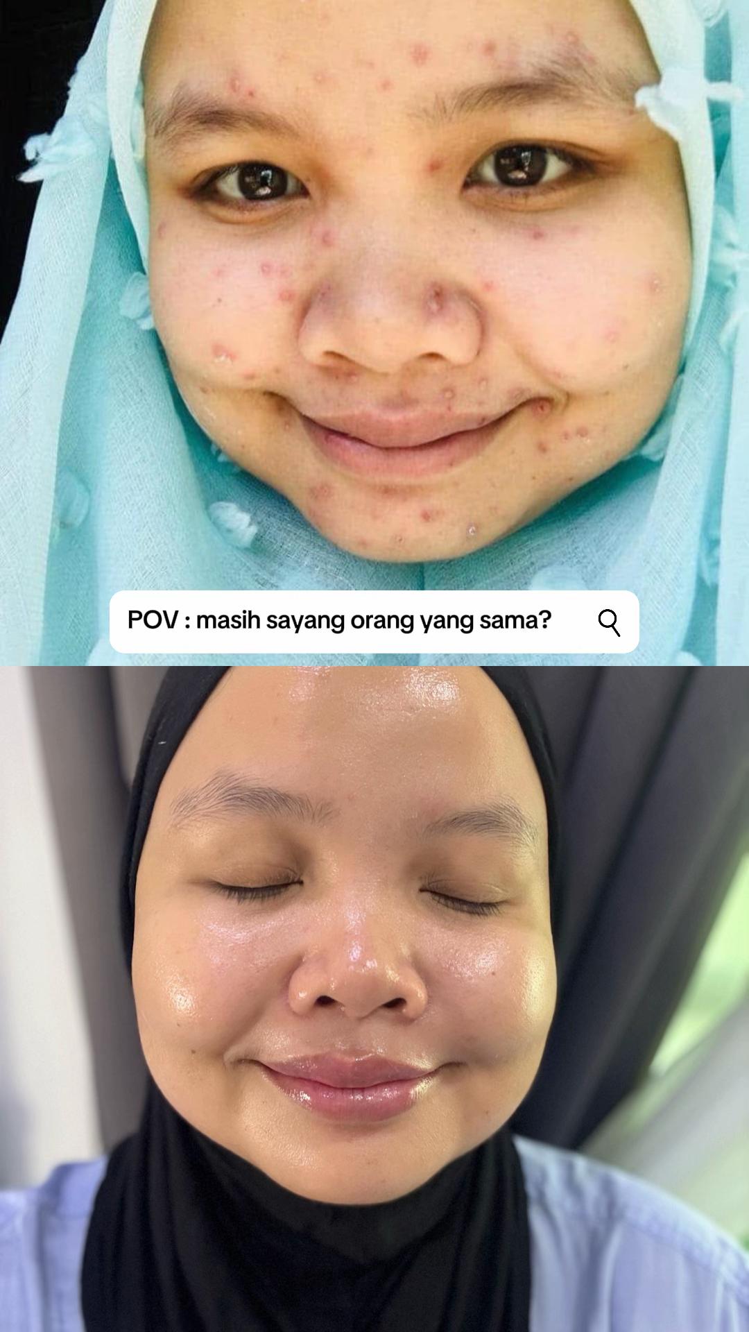 @Nurul Hakimy | Skin & Wellness