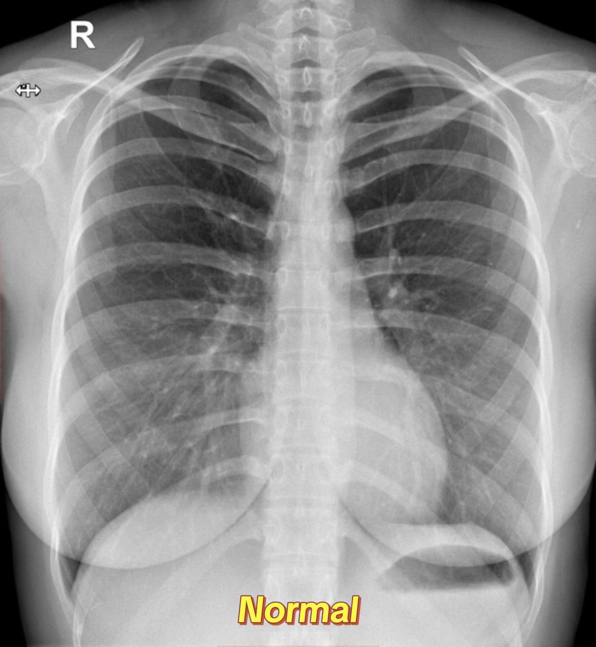 @Sobat Radiology