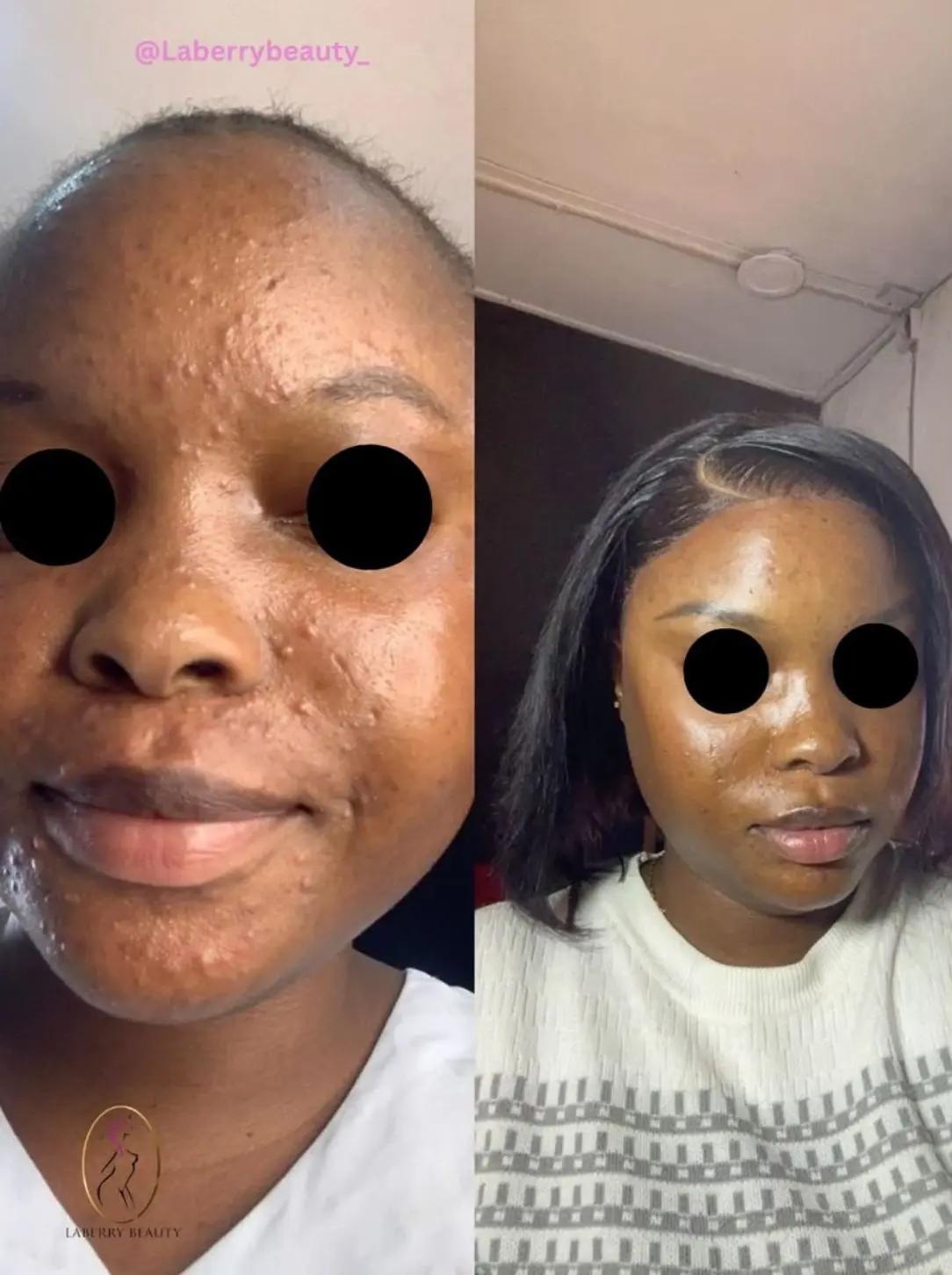 @LaBerry | Luxury Medspa Lagos