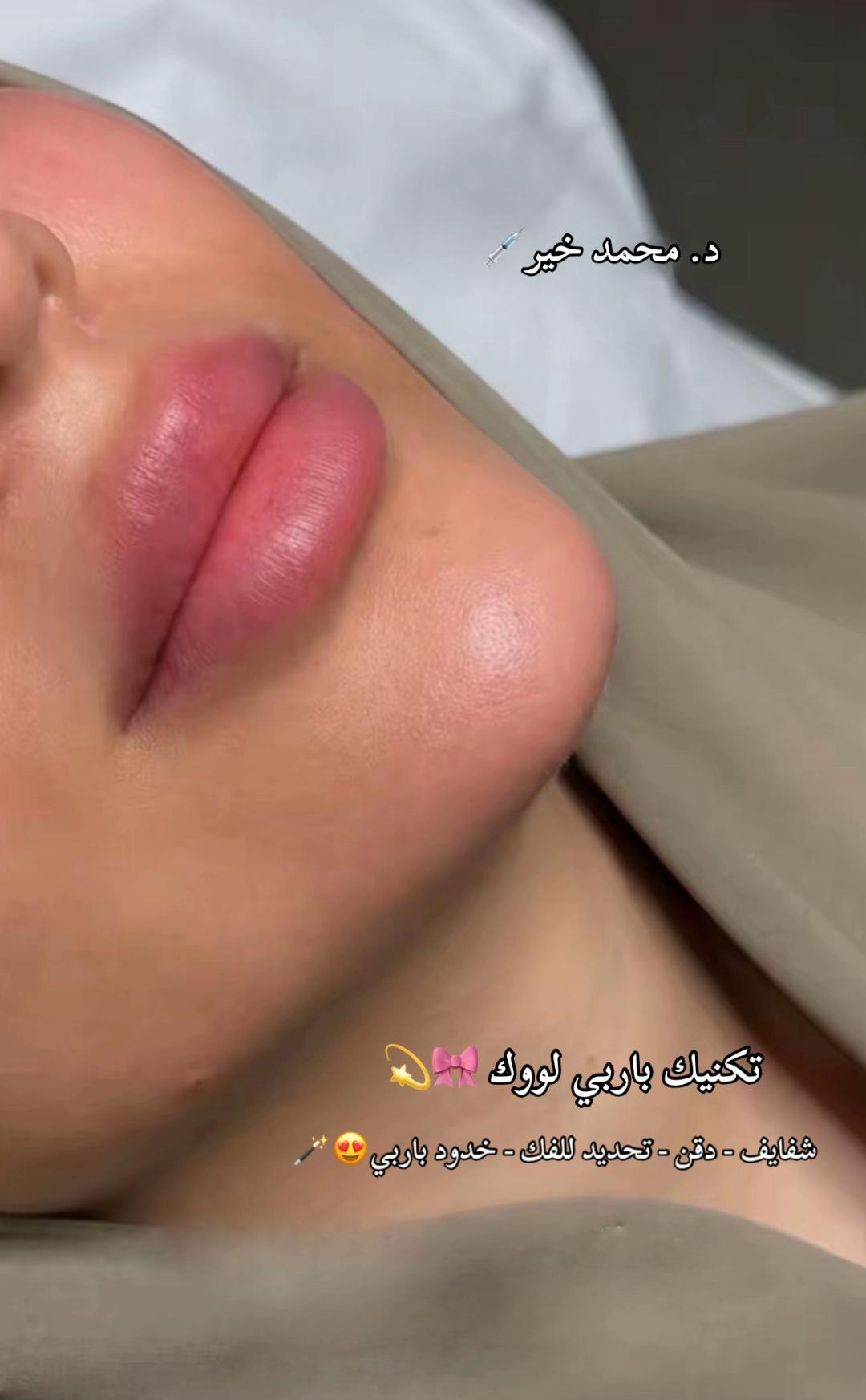 @Dr. Mohamed khier