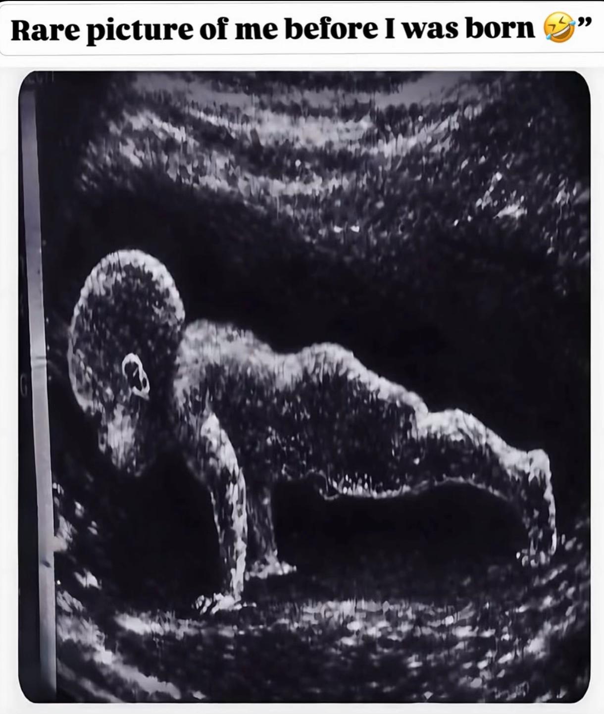 @Real.Mitch🇦🇺