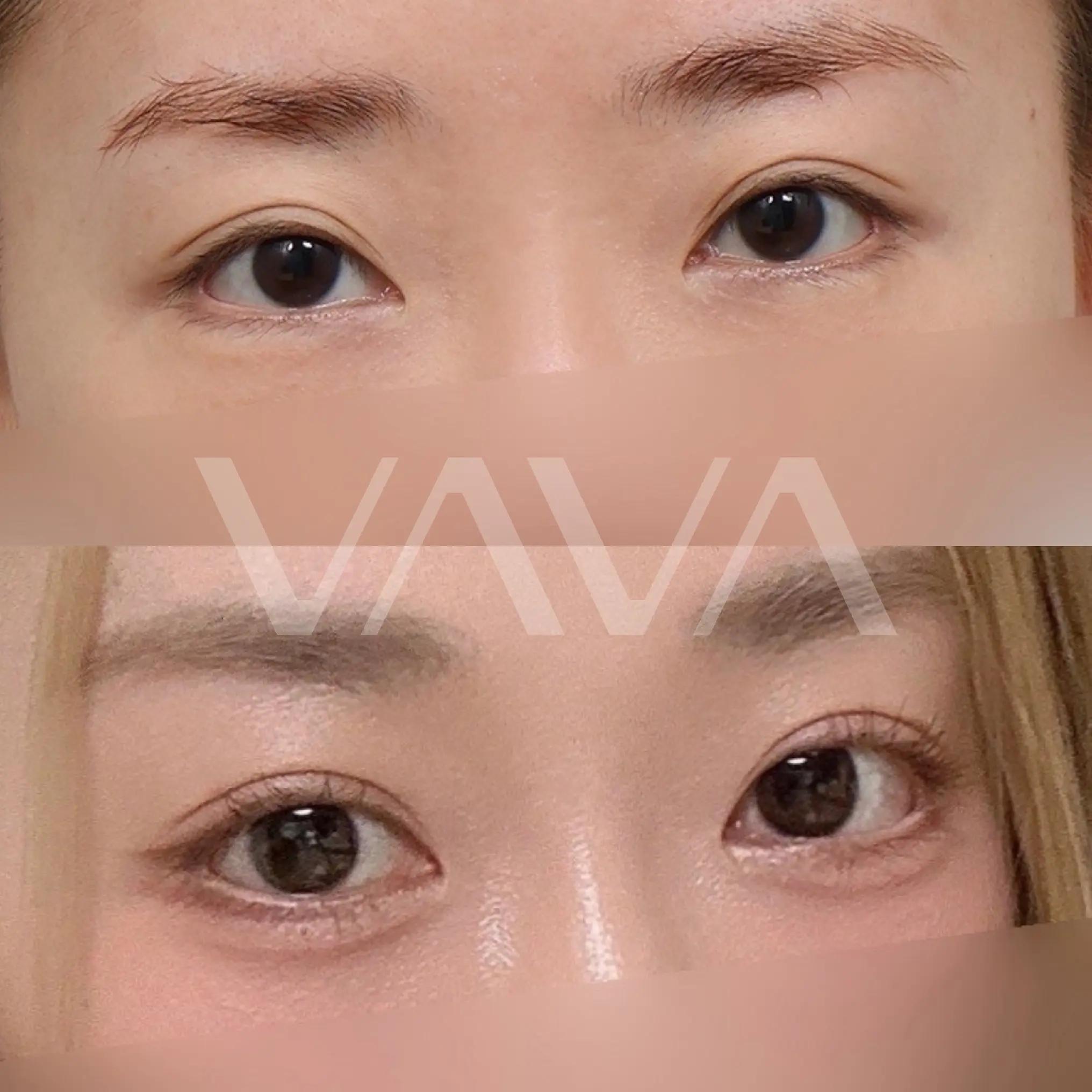 @VAVA美容整形外科