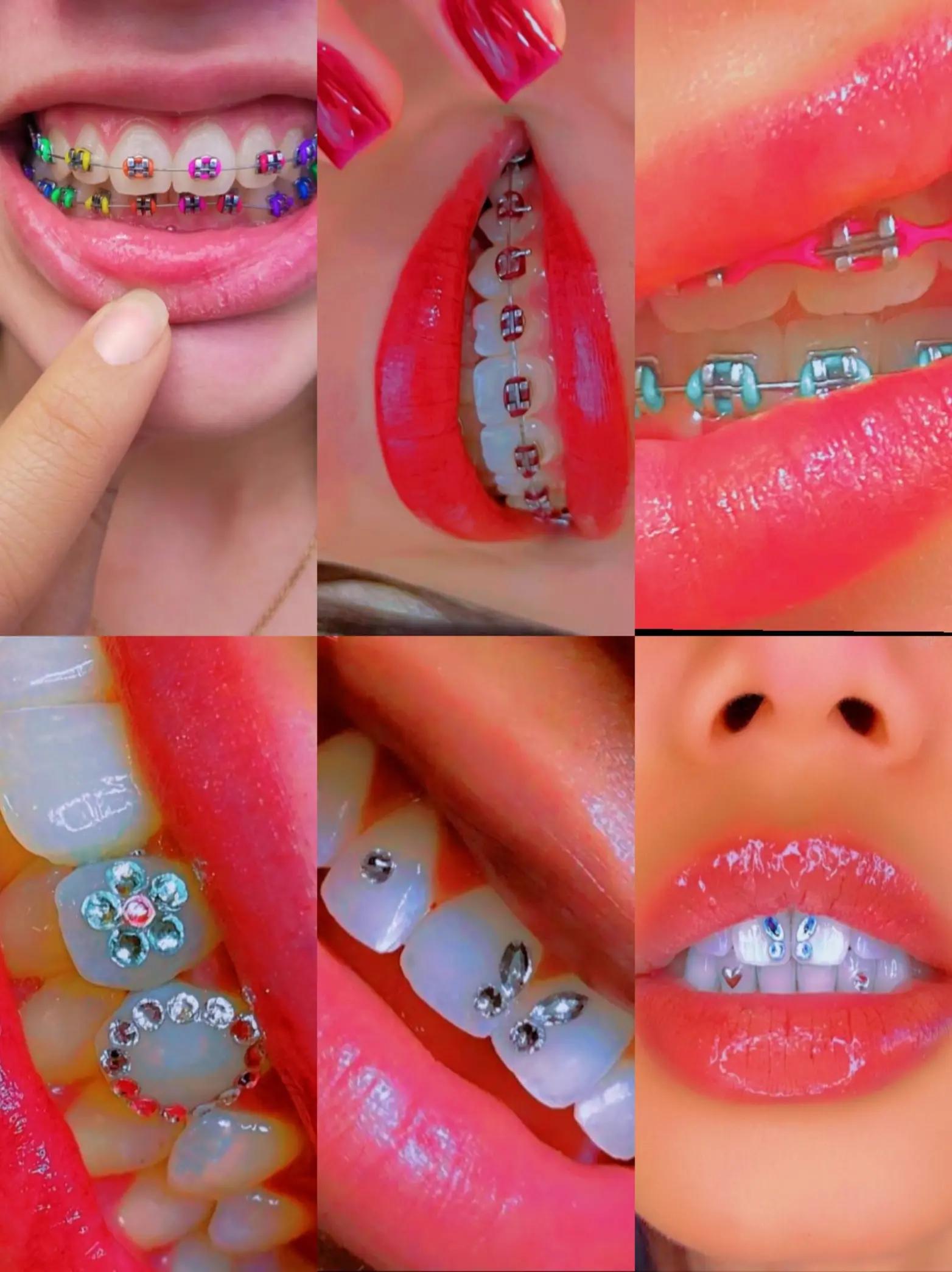 @Dr.Naasir🦷🩵🩺