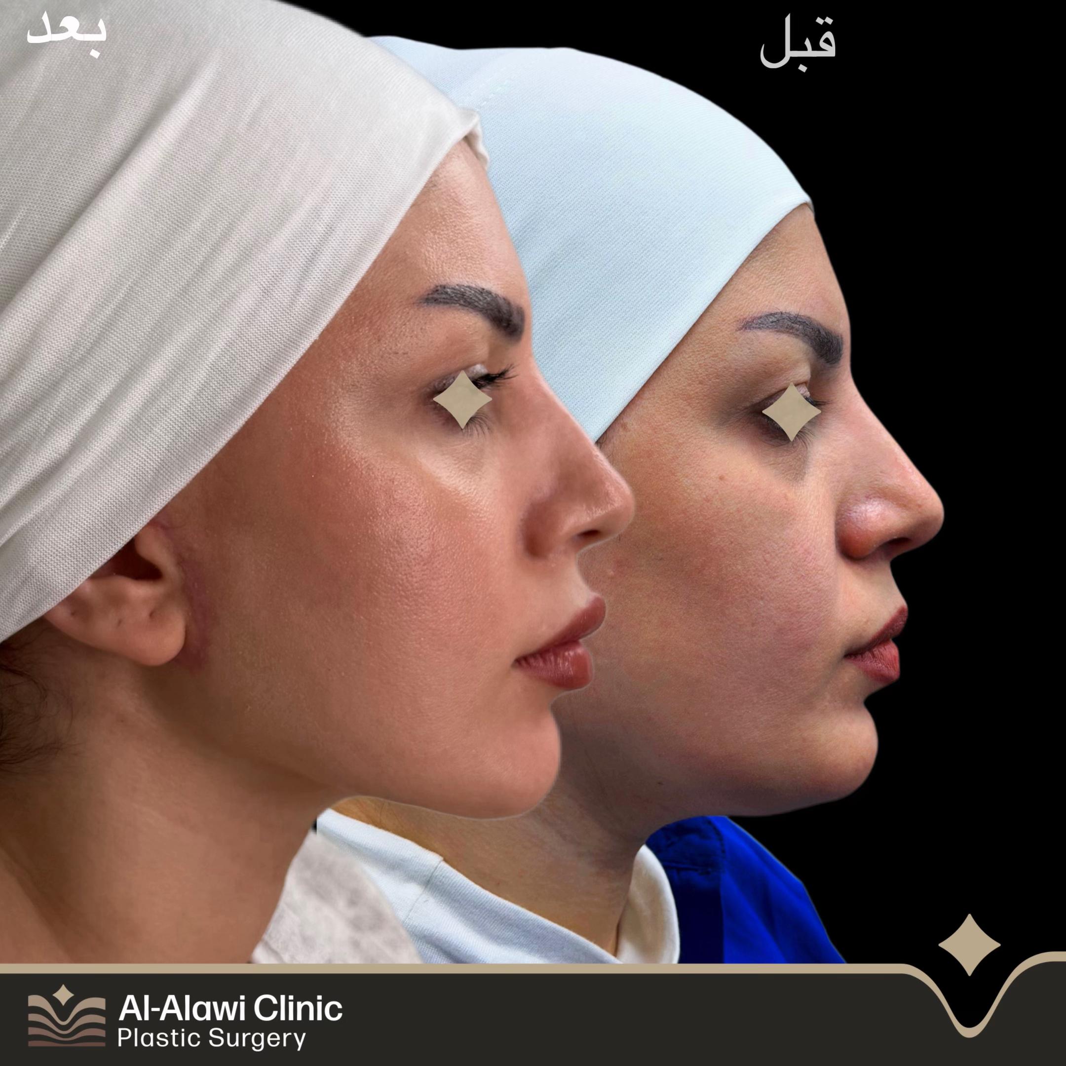 @dr.mhmd.alalawi