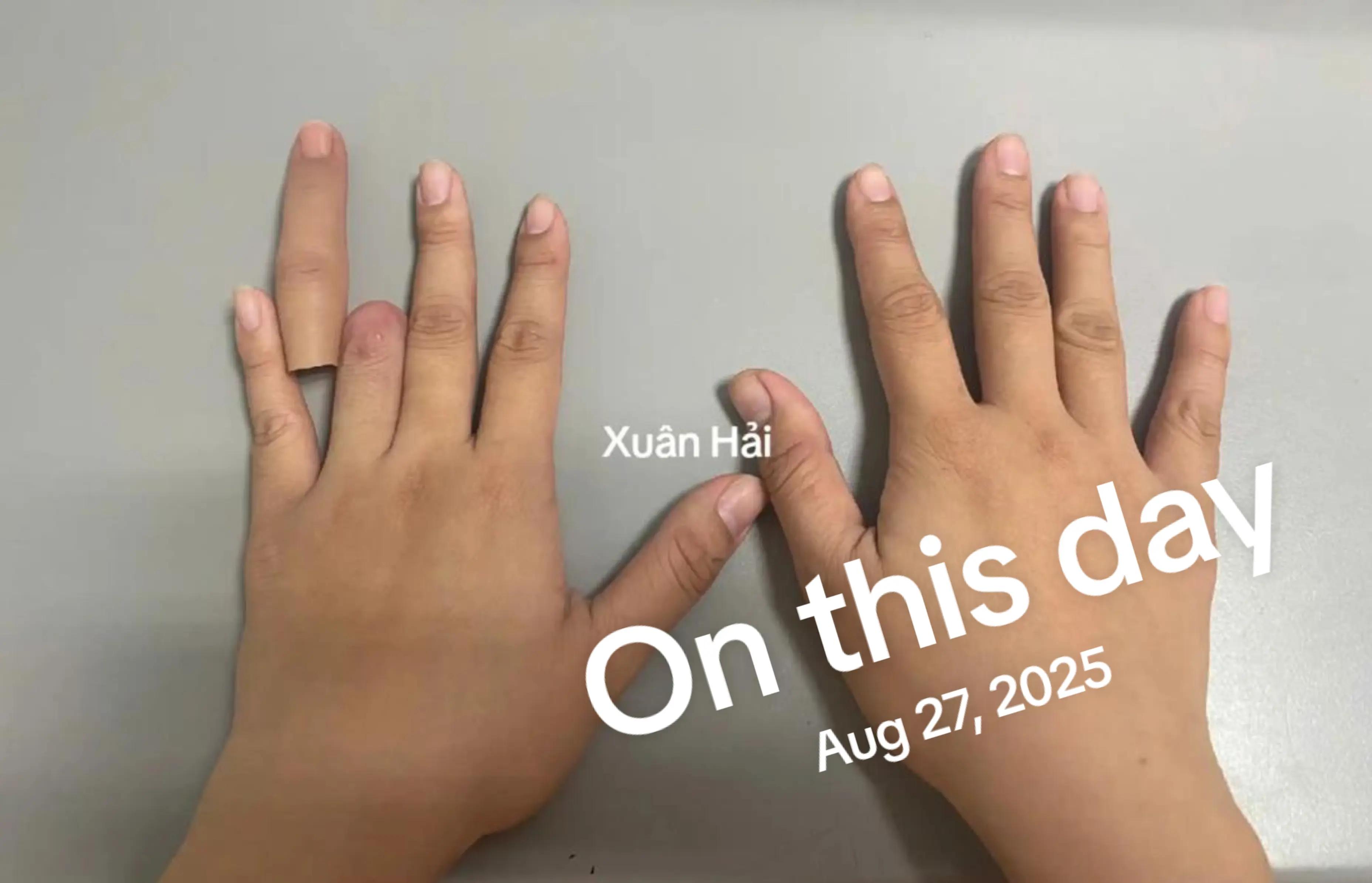 @Hải Râu Tay Chân Giả