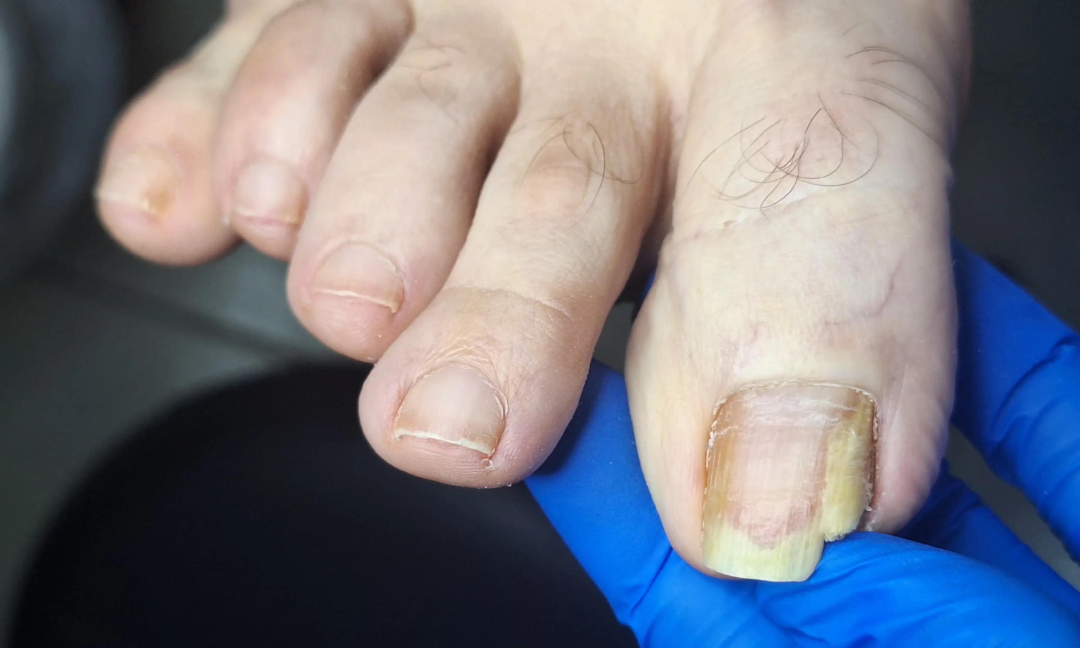 @Quiropodia HAPPY FOOT🇨🇷