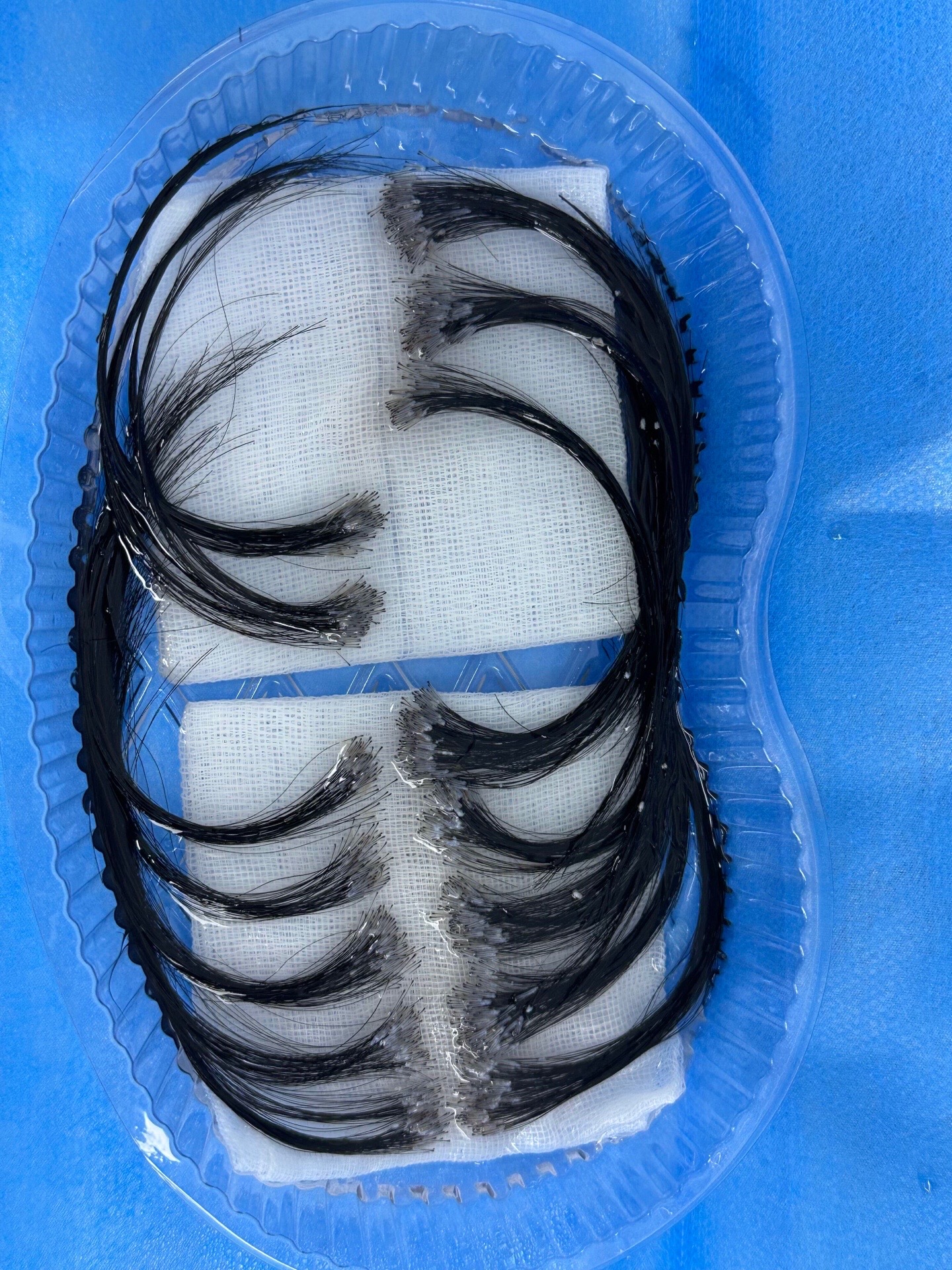 @HAIR TRANSPLANT WANG🇨🇳