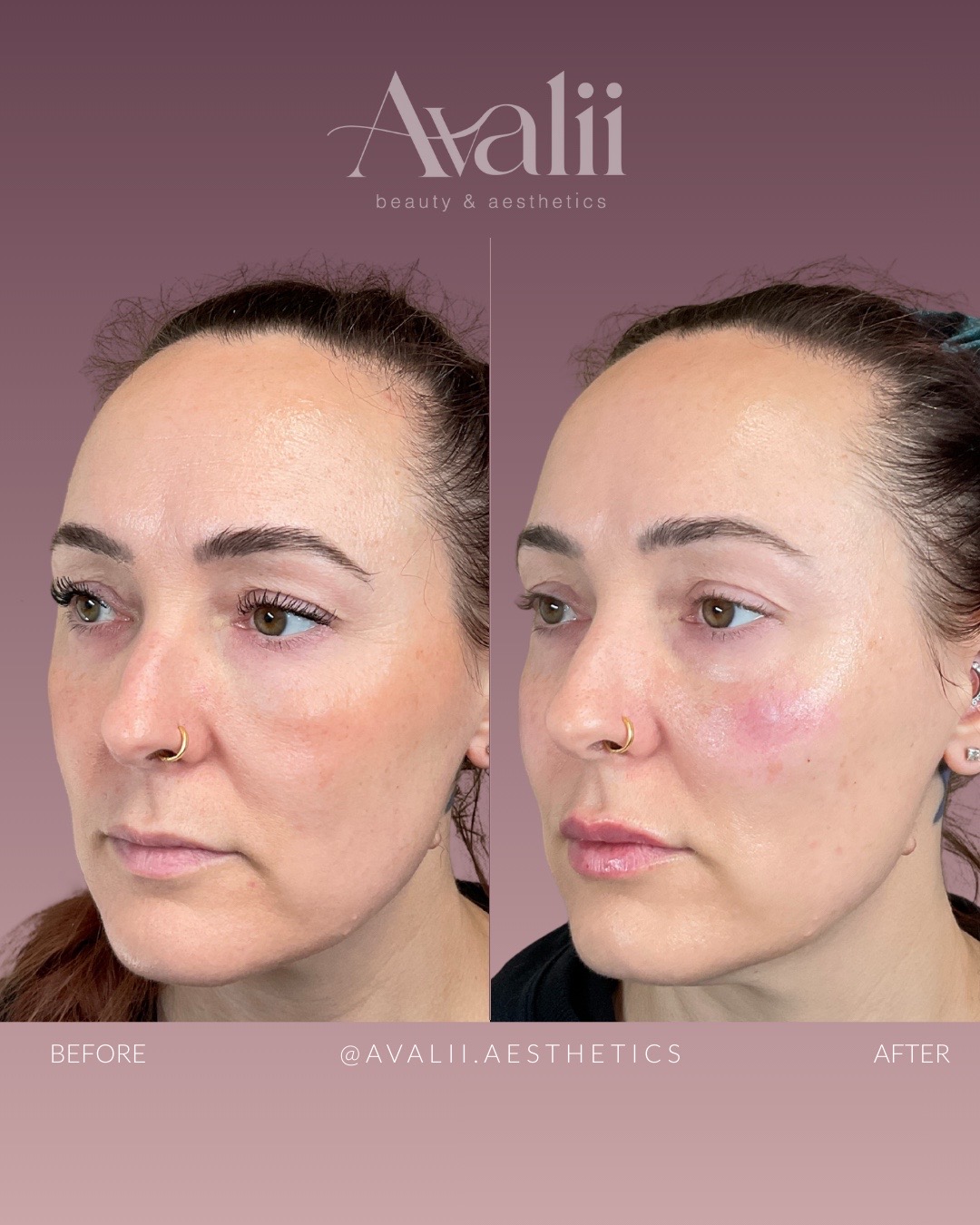 @Avalii Aesthetics