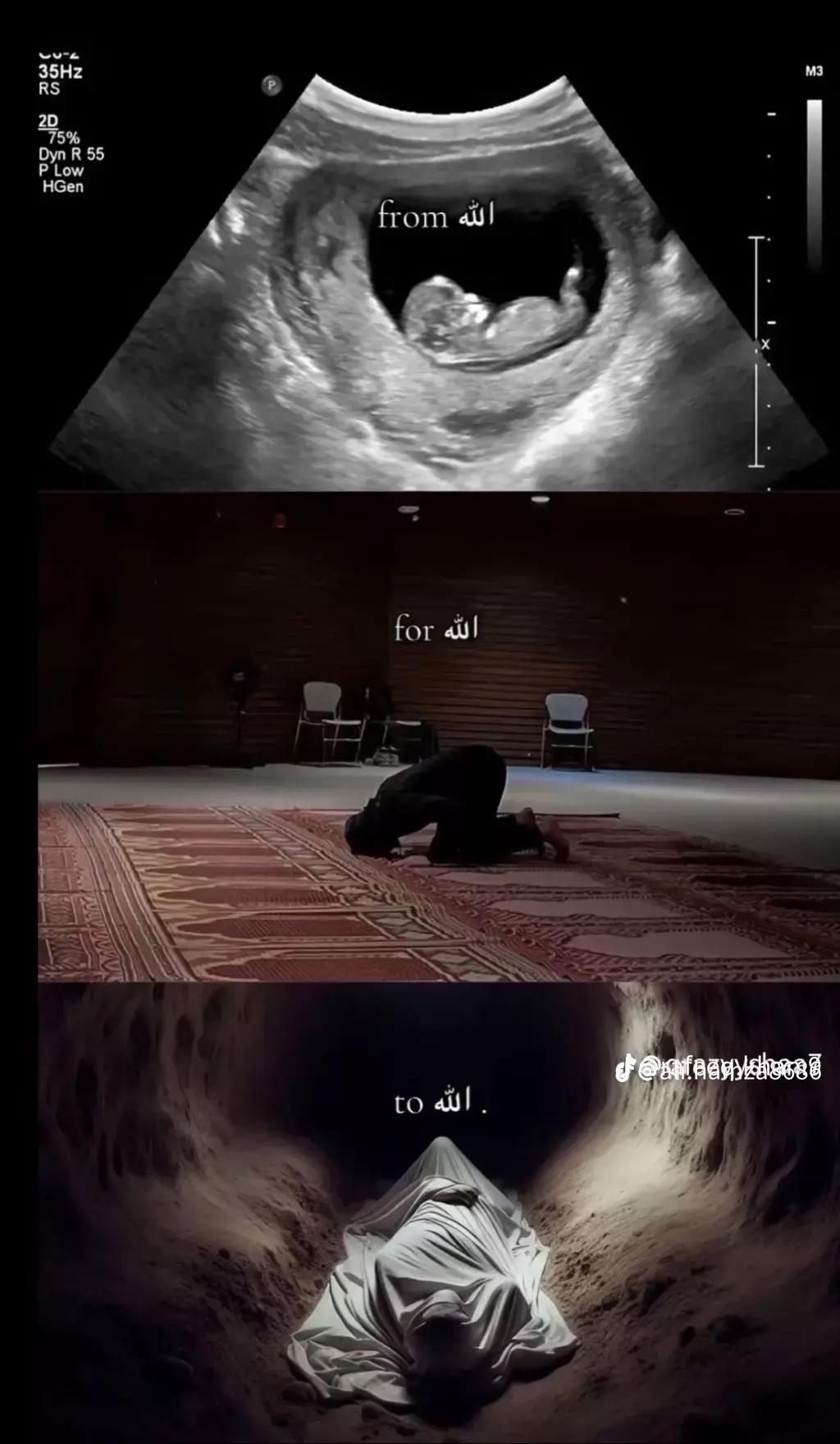 @𝐍𝐨𝐦𝐢 💔🥺
