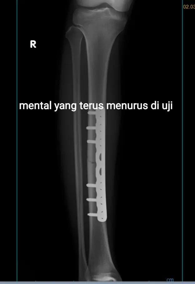 @yudha13