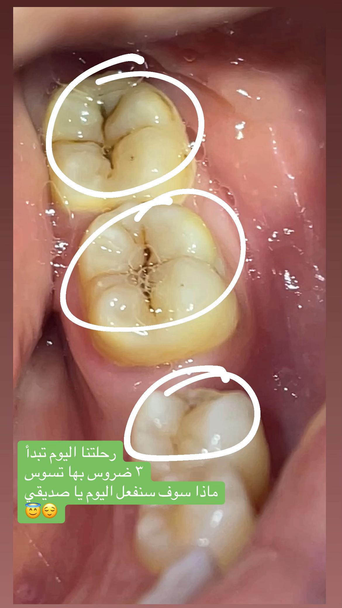 @Dr Mostafa Eita