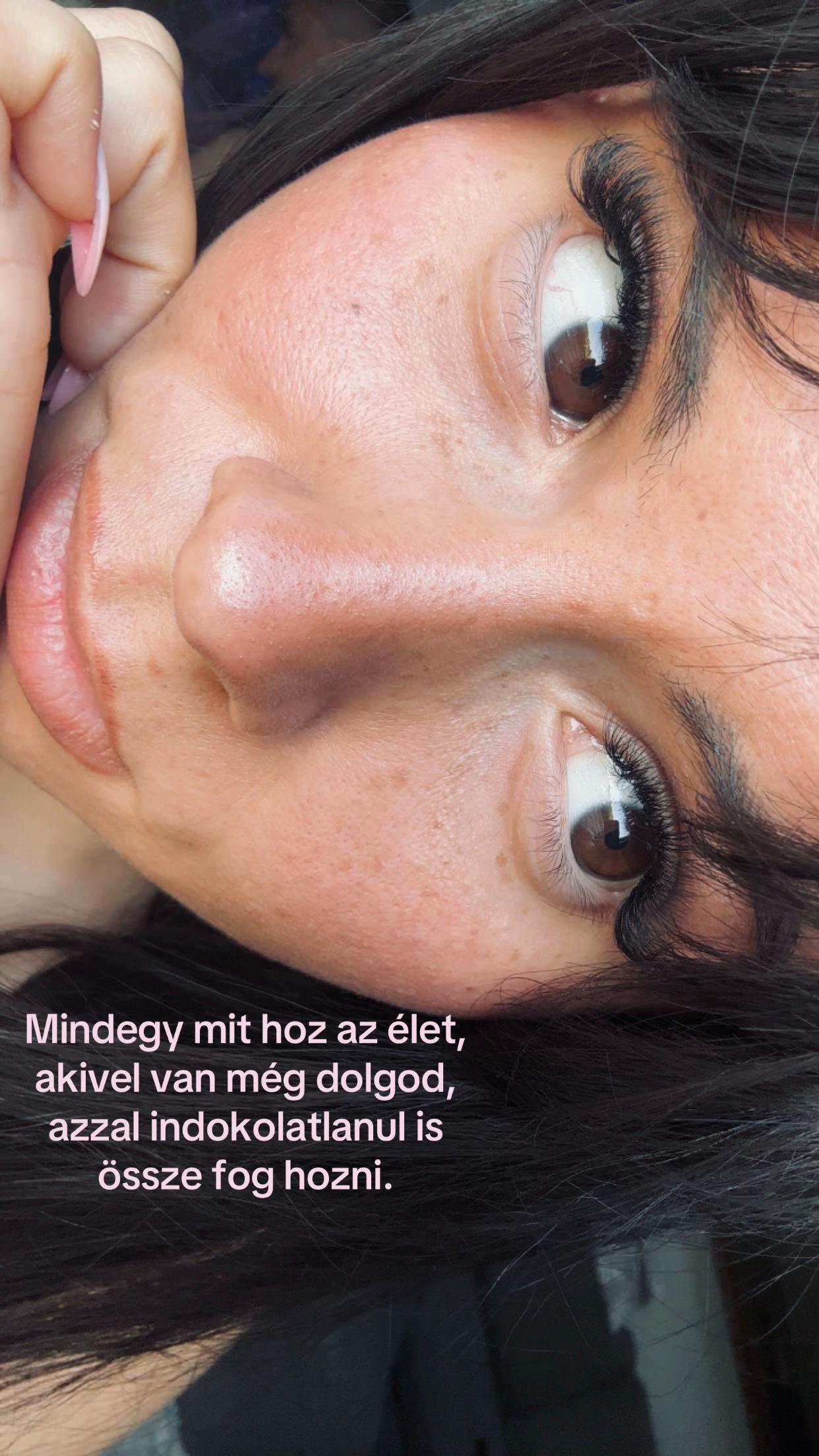 @Mira