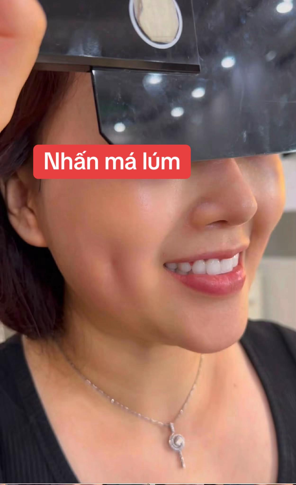 @Fb Nguyễn Linh Na🇹🇼