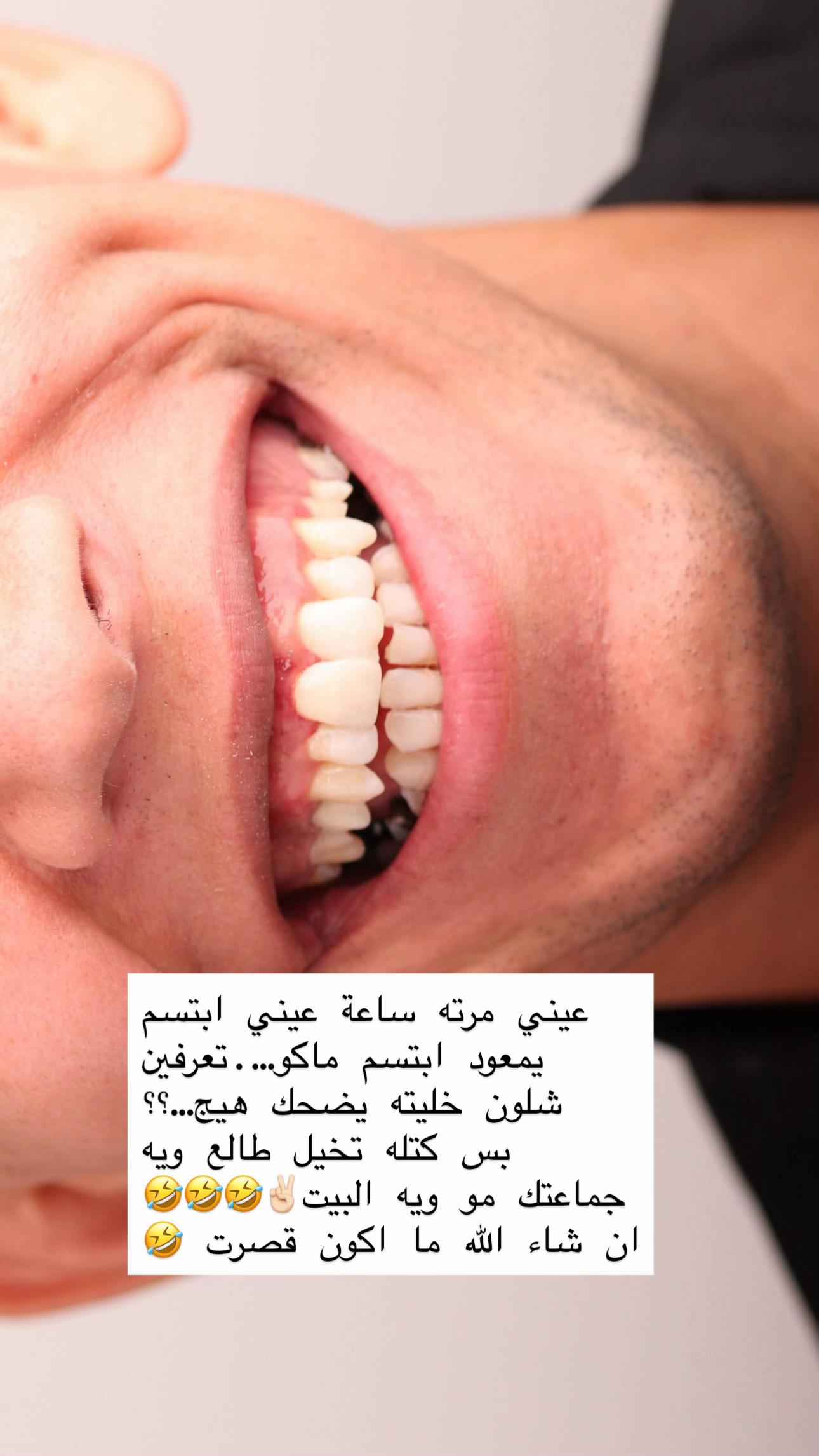 @Dr.Noor Mahjoba👩🏻⚕️🦷💉💎