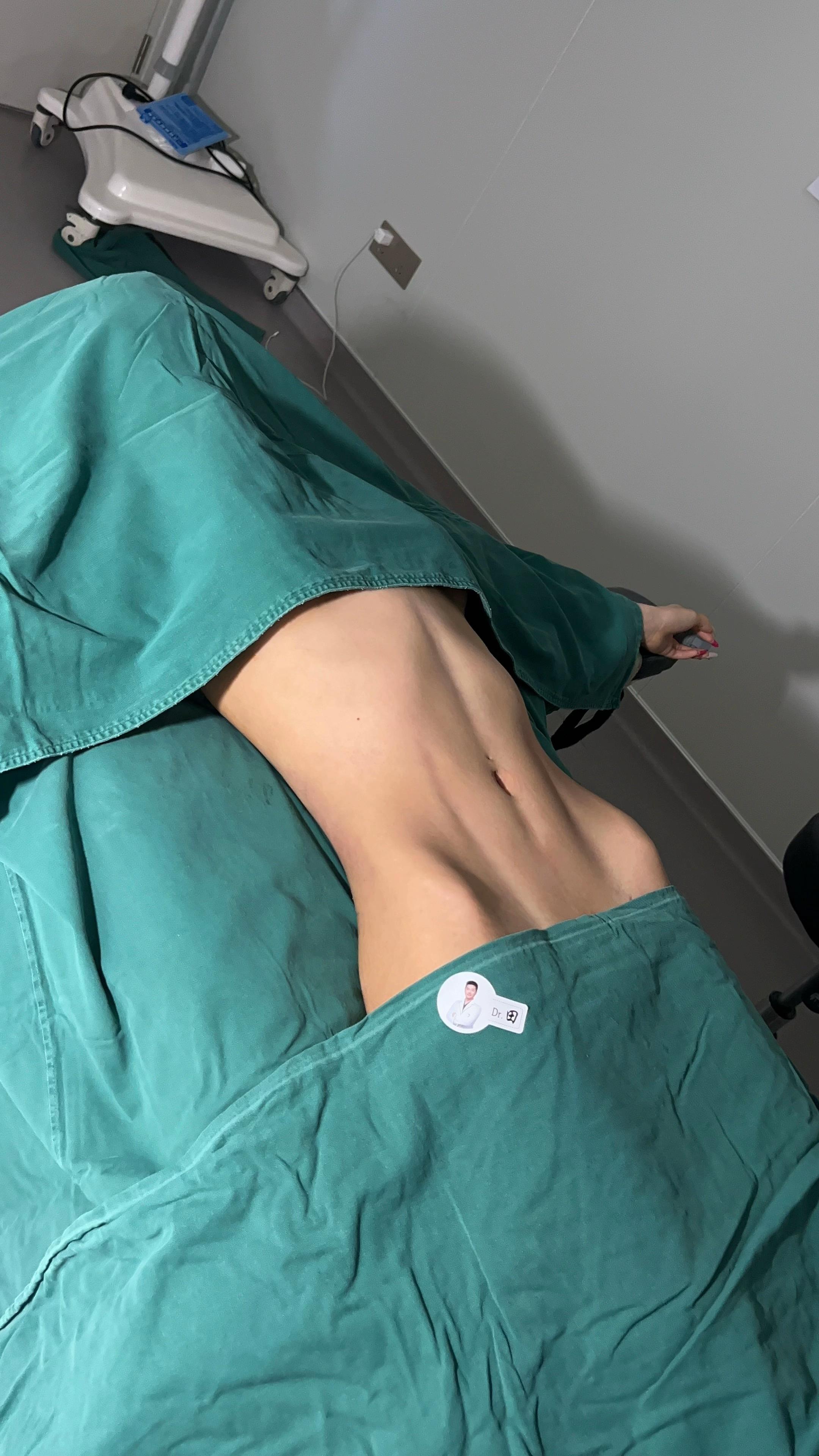@Nose augmentation