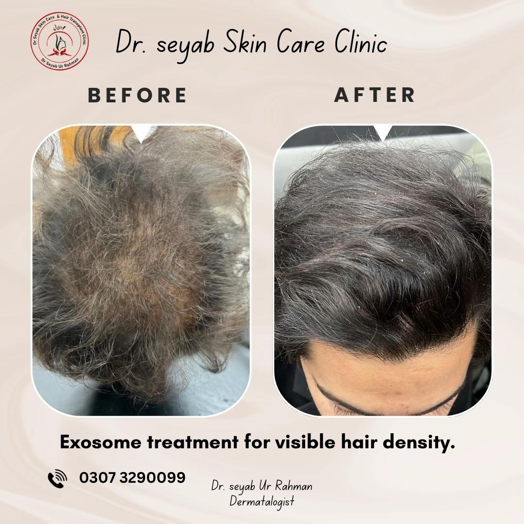 @Dr seyab Dermatologist