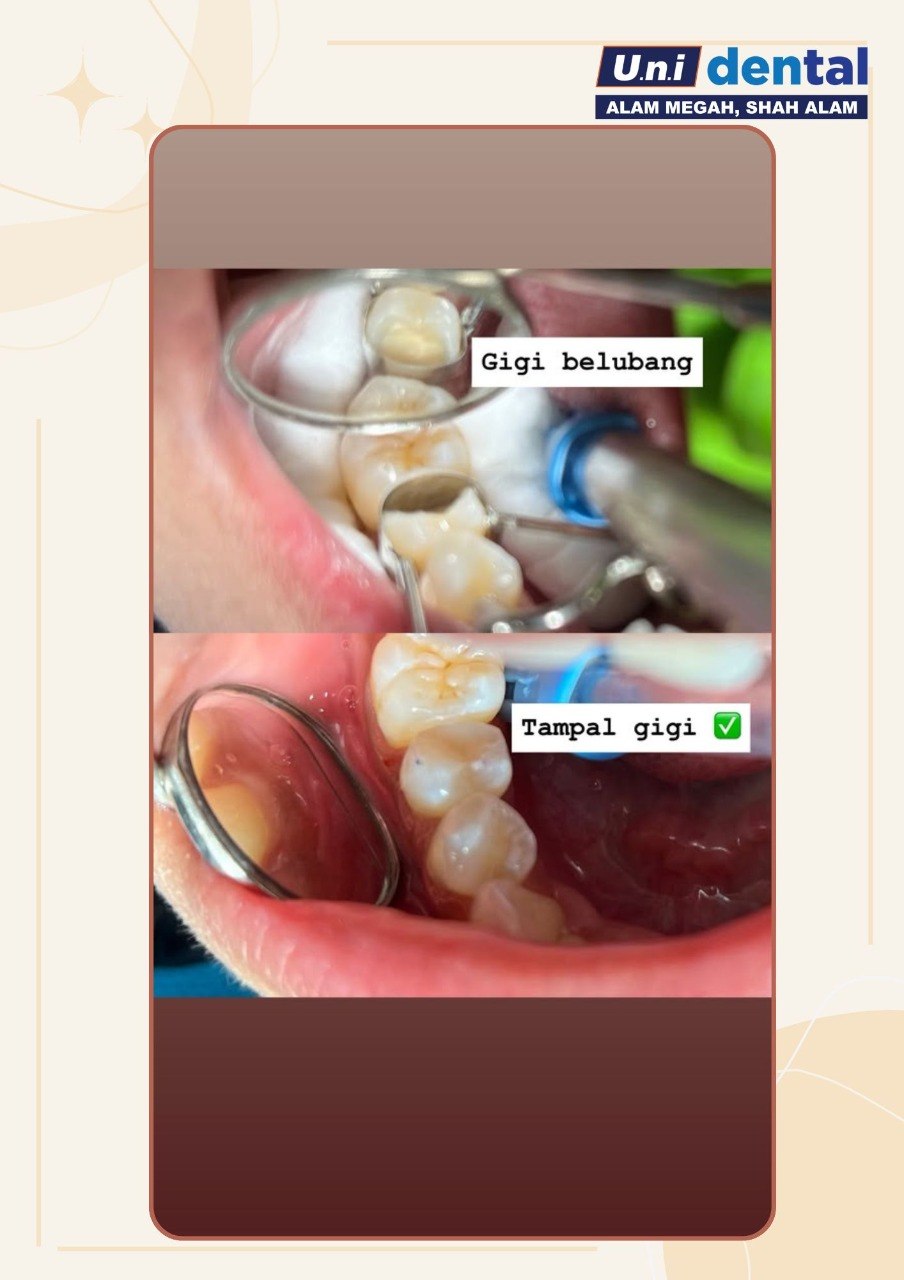 @Klinik UNI Dental Alam Megah