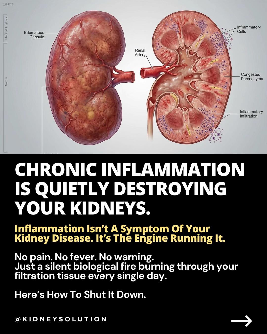 @Kidneysolution