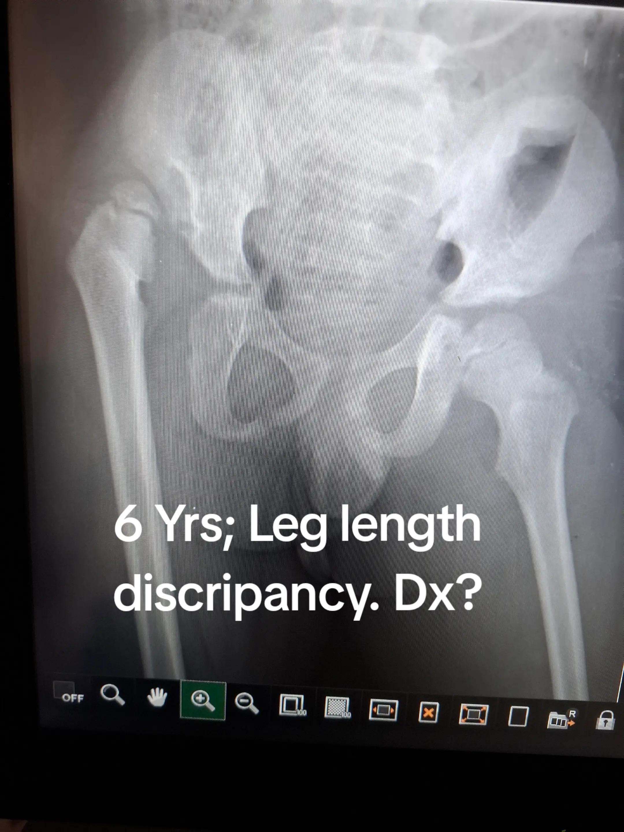 @Dr Wubie Endalew(Radiologist)