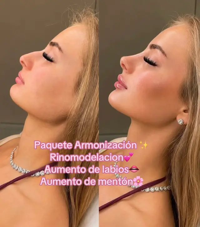@Spa La Bella