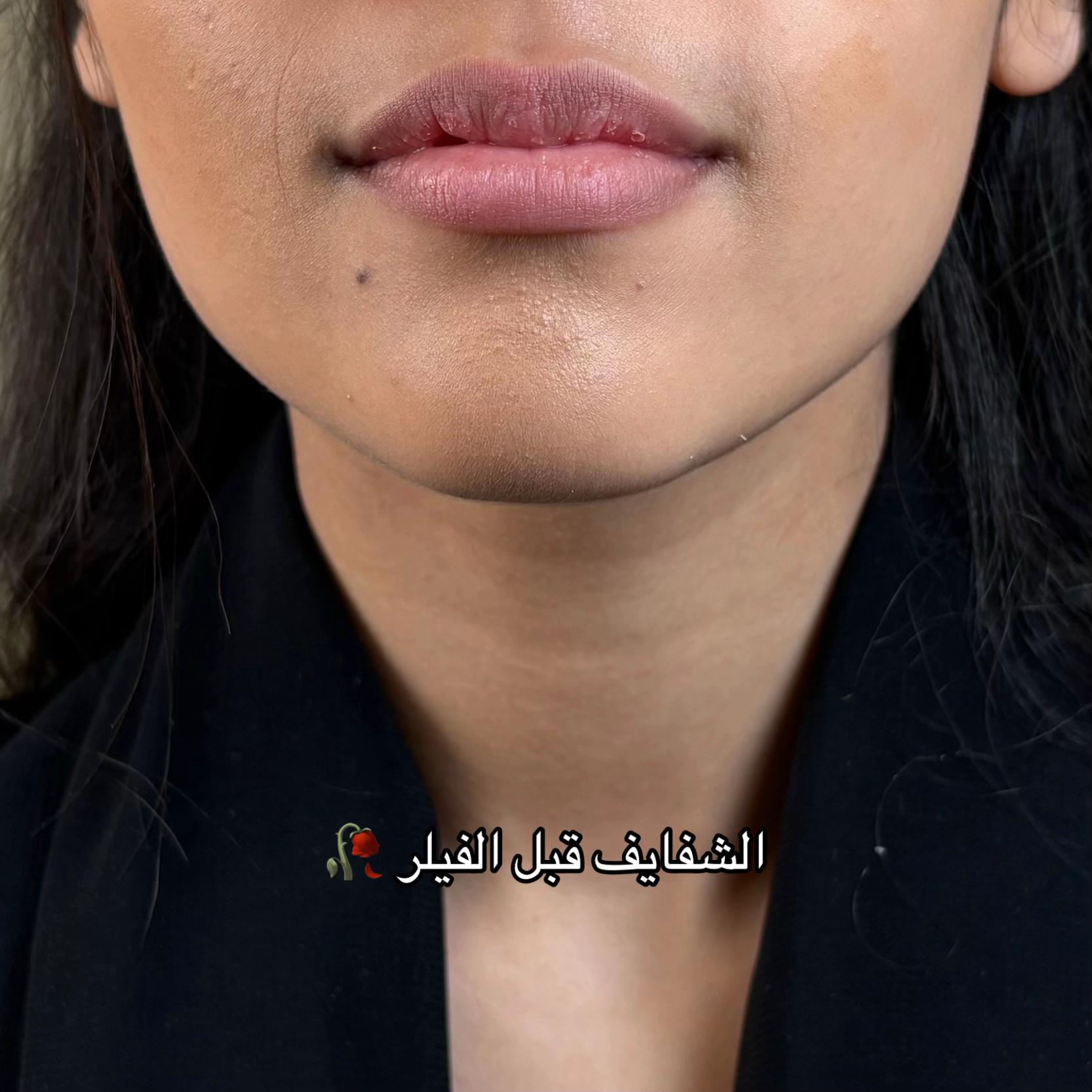 @مزدانه (فرع الملك عبدالله)