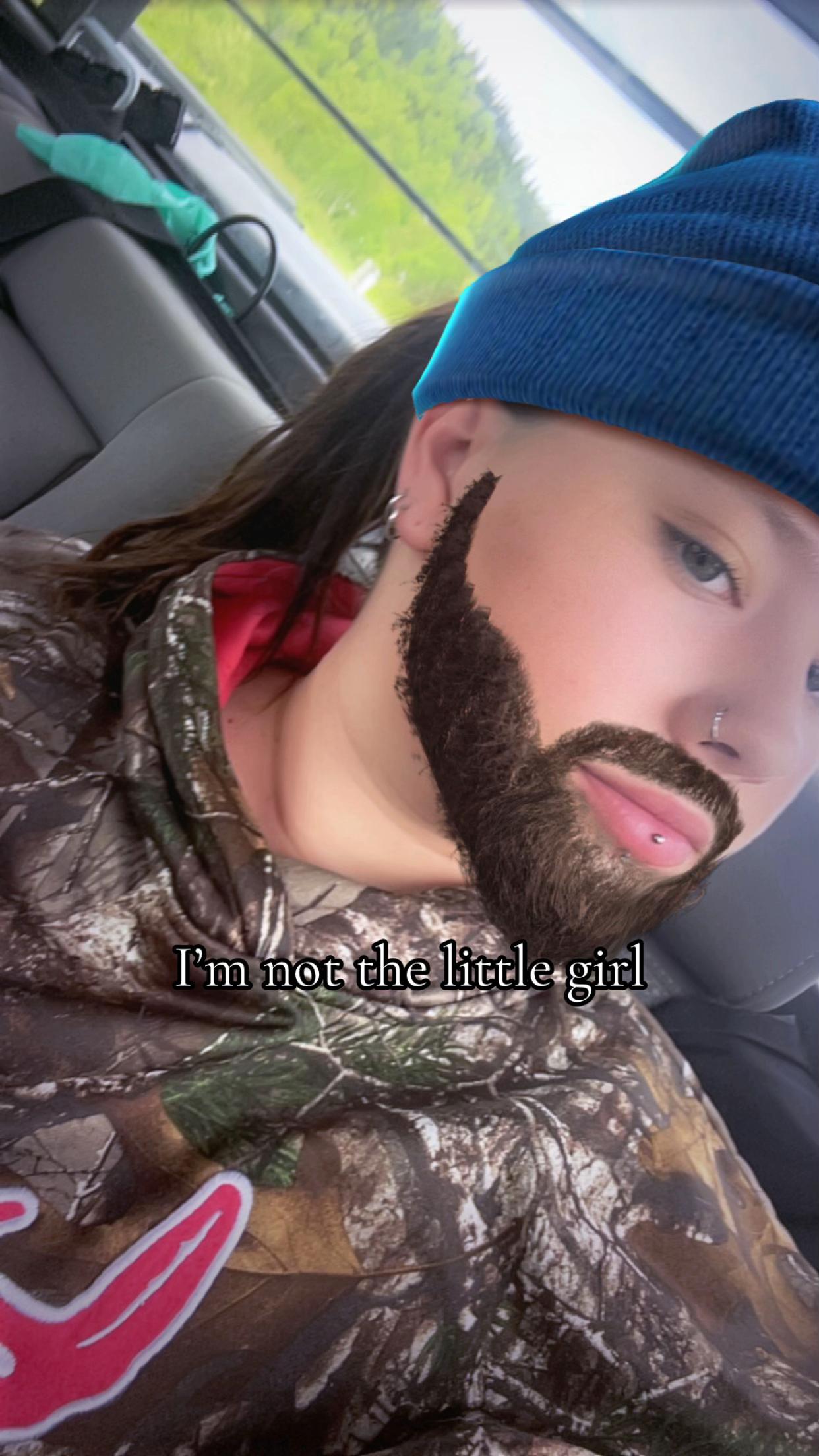 @Alexis strub