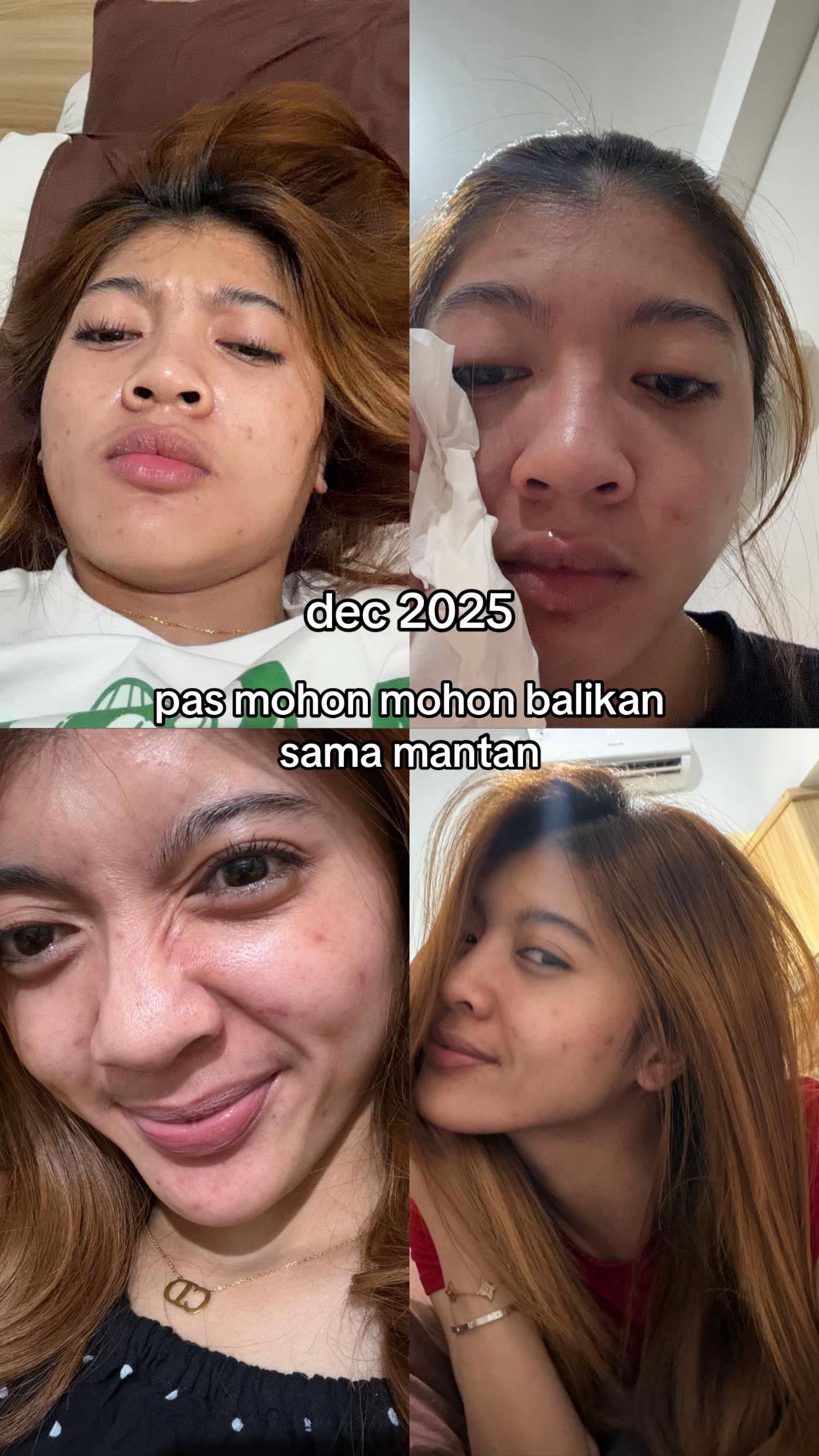 @putri