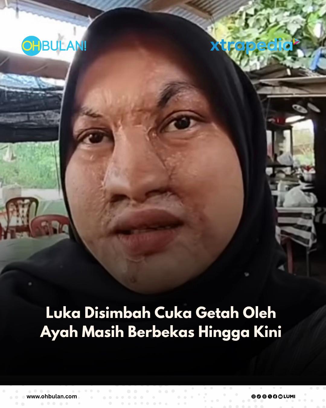 @OHBULAN!