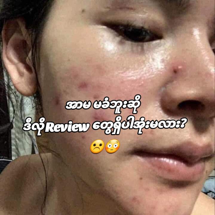 @Jelly Mask Skincare - Yangon