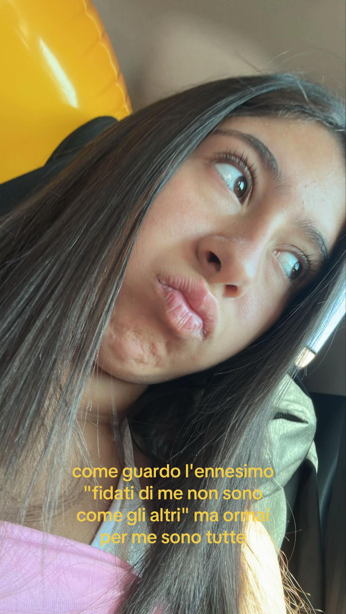 @23