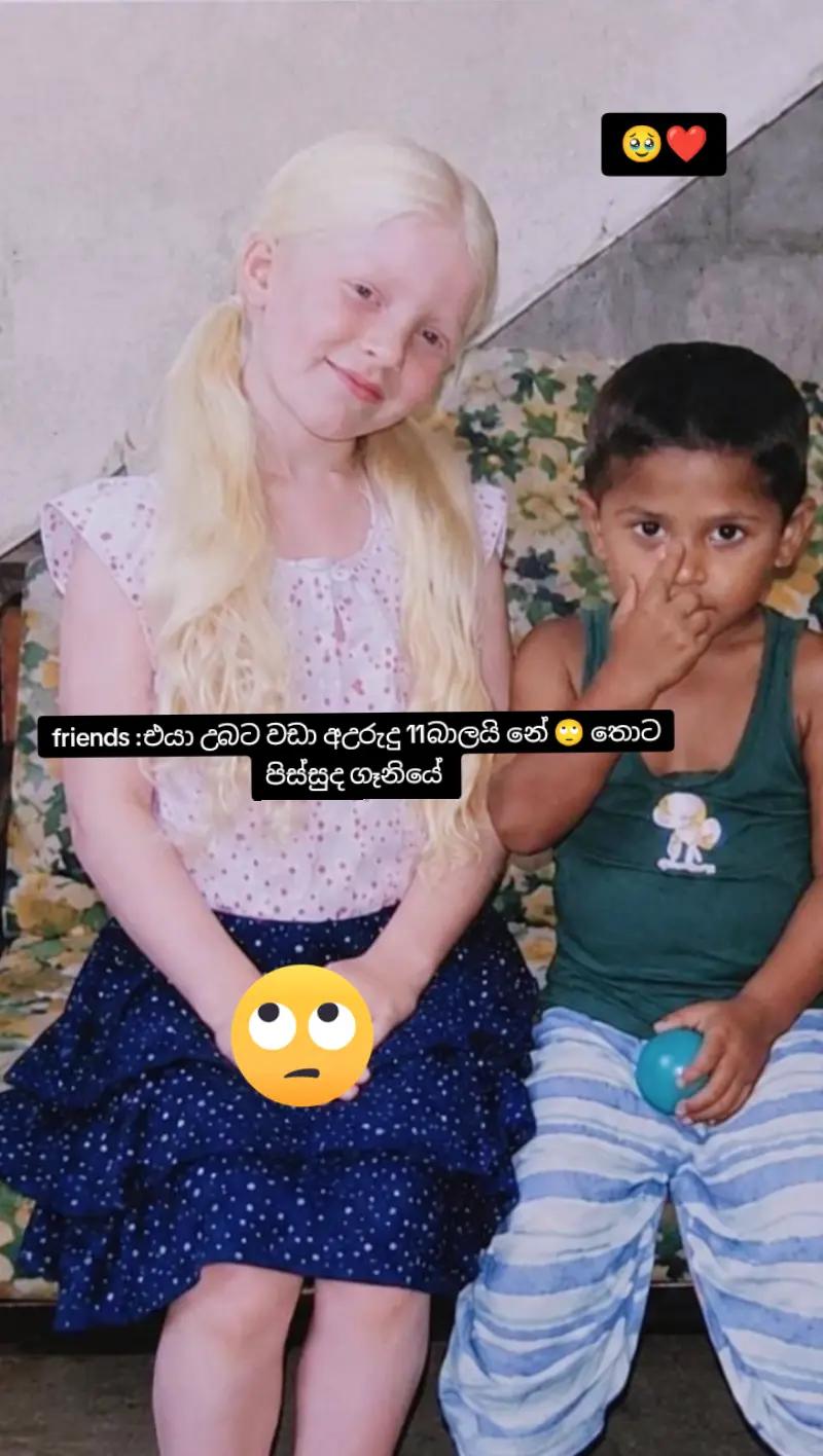 @🧝🤍Albino Girl LK🤍🧝🩵
