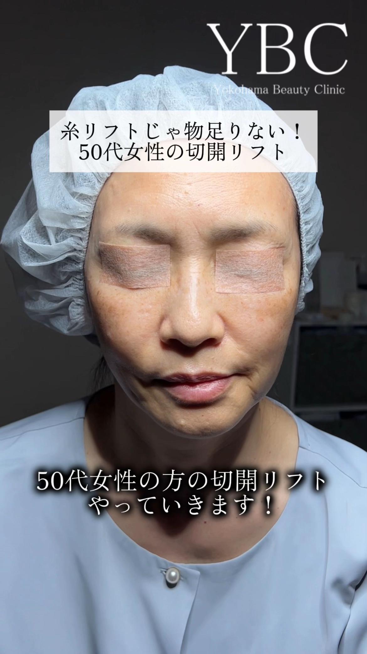 @イソセン/美容外科医（磯村亮輔院長）