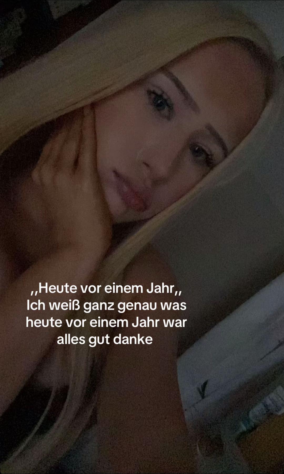 @Alea