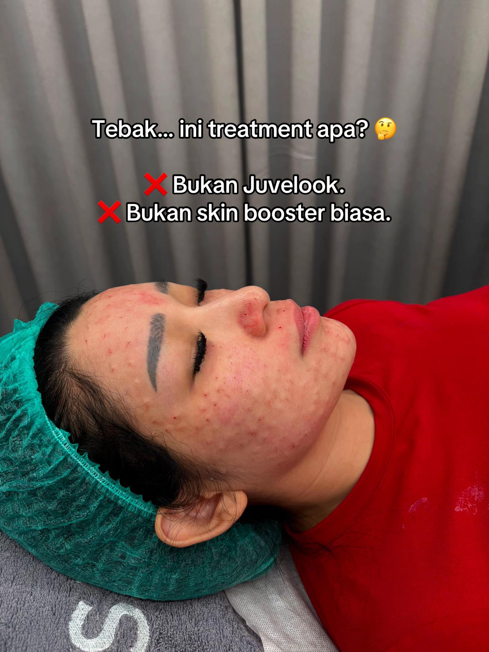 @iamhanadeline