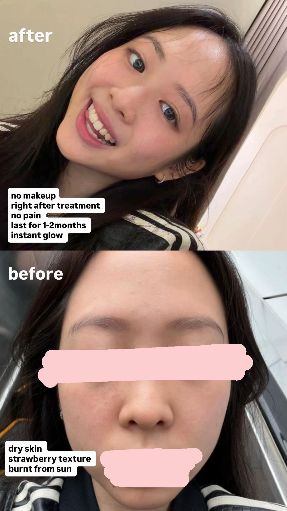 @Apryl