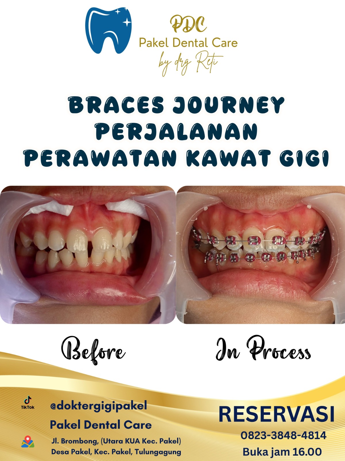 @Pakeldentalcare