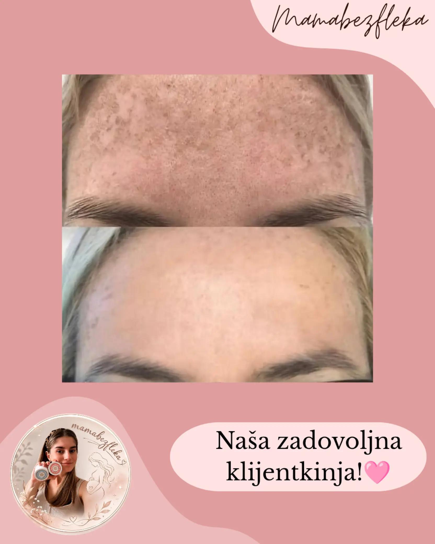@Mama bez fleka