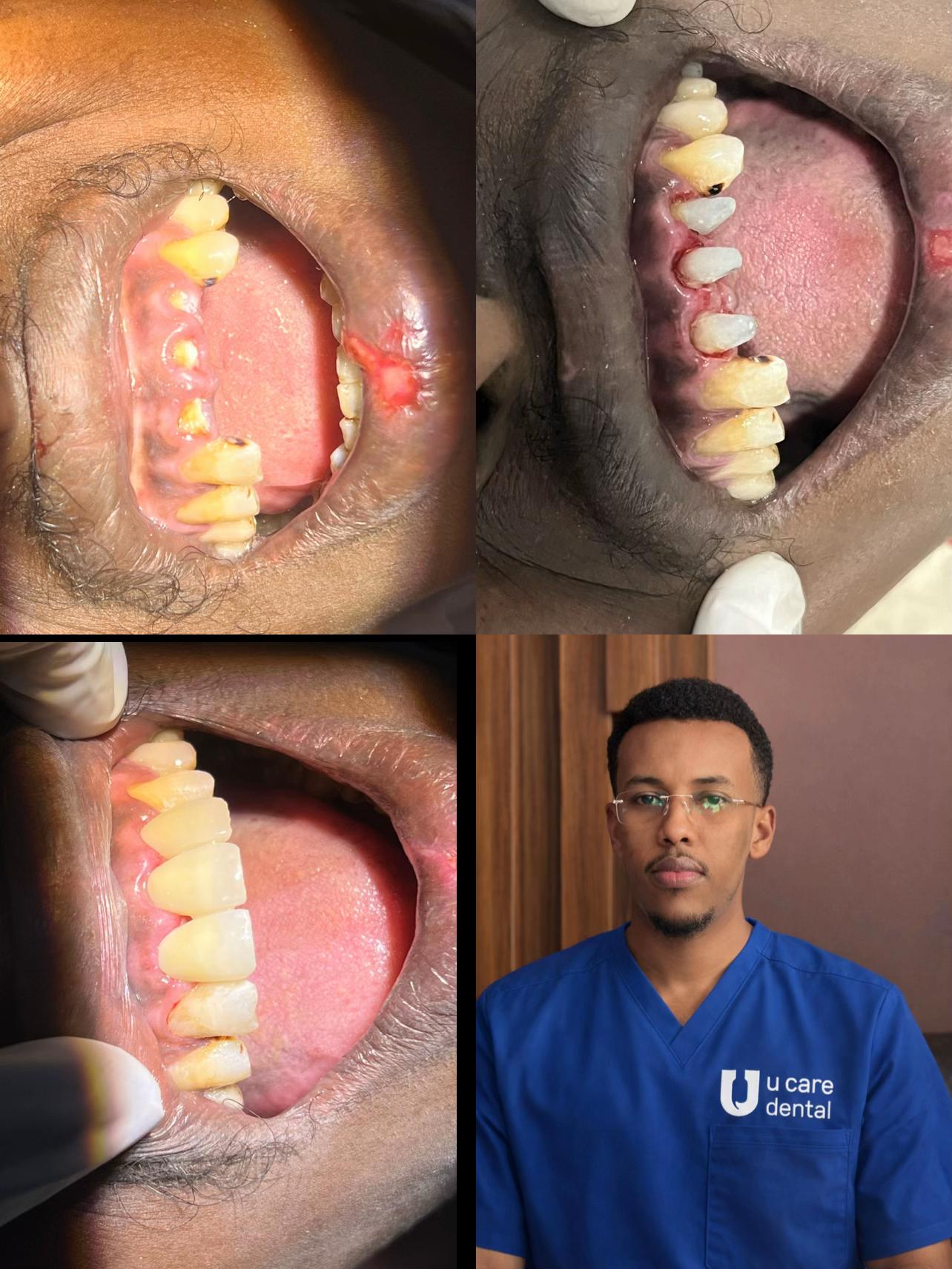 @Dr Abdirahman hassan laari