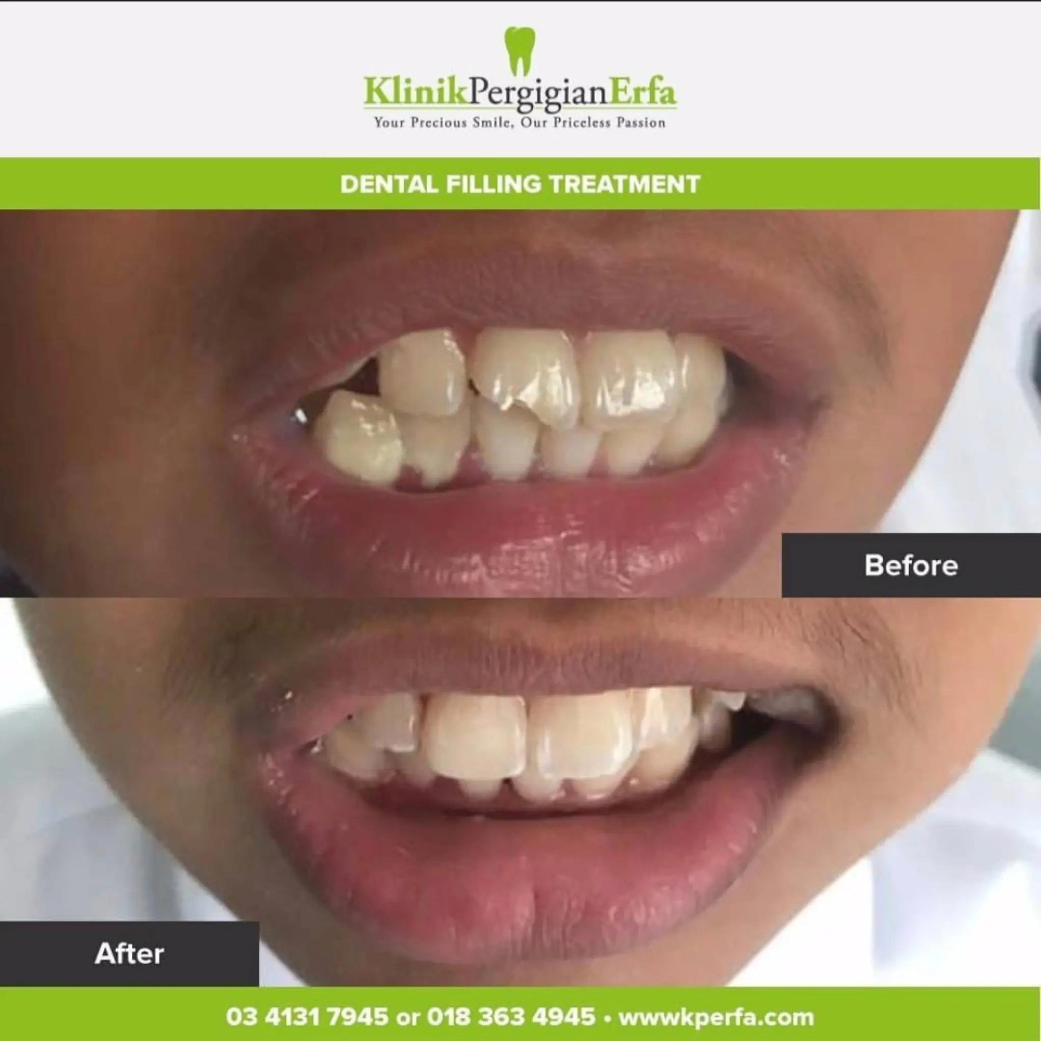 @Klinik Pergigian Erfa