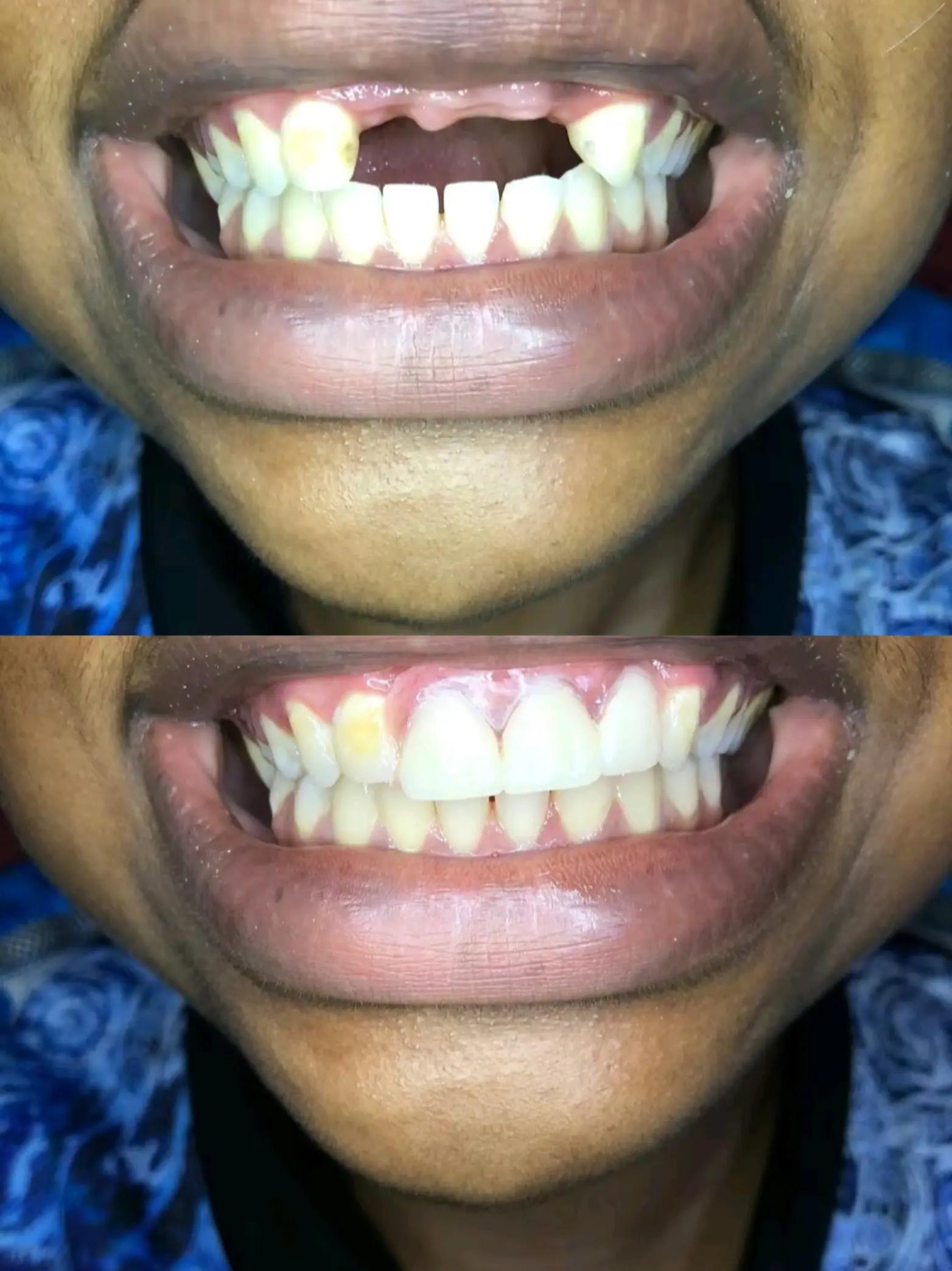 @Dr.Naasir🦷🩵🩺