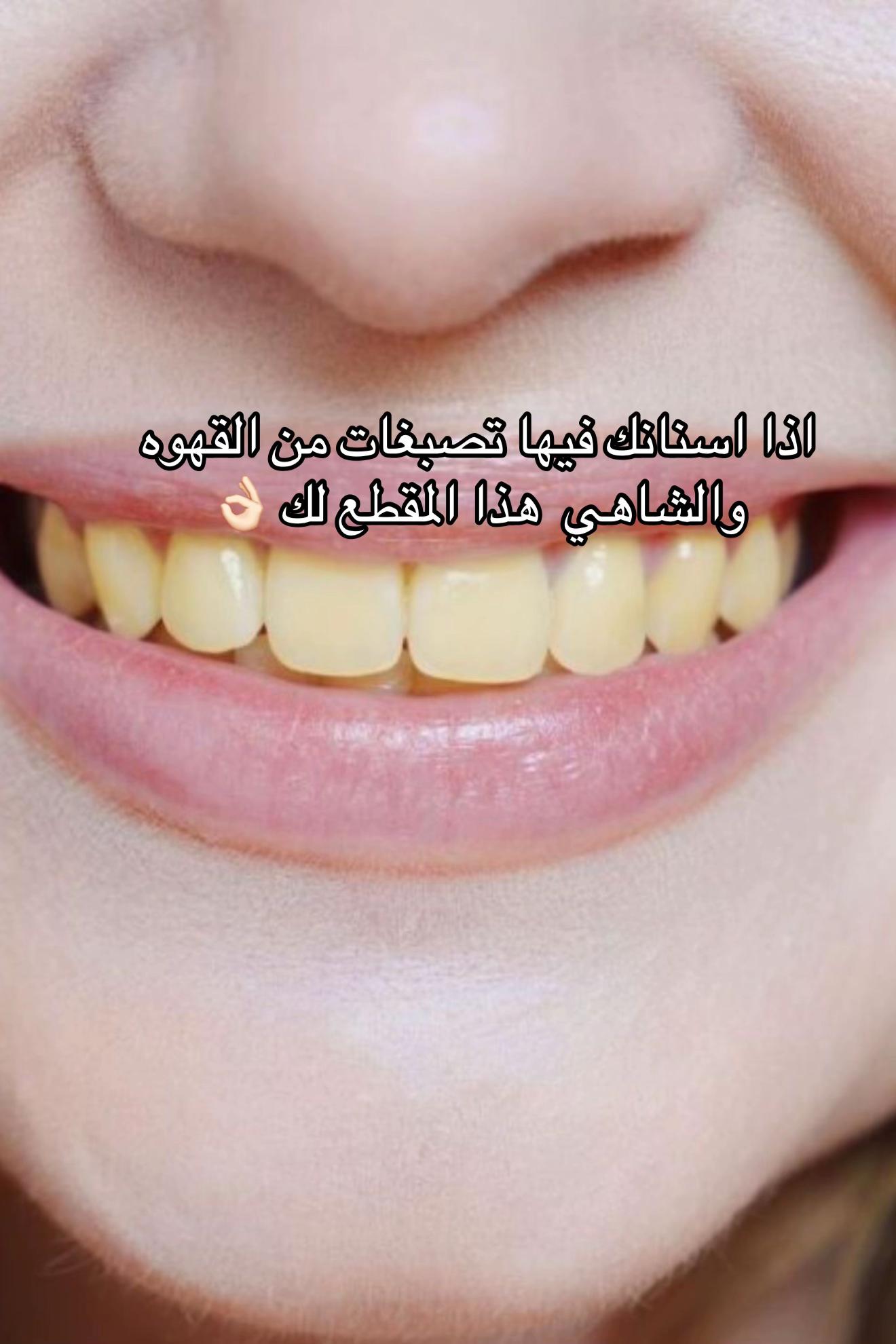 @Gaudy|قدي