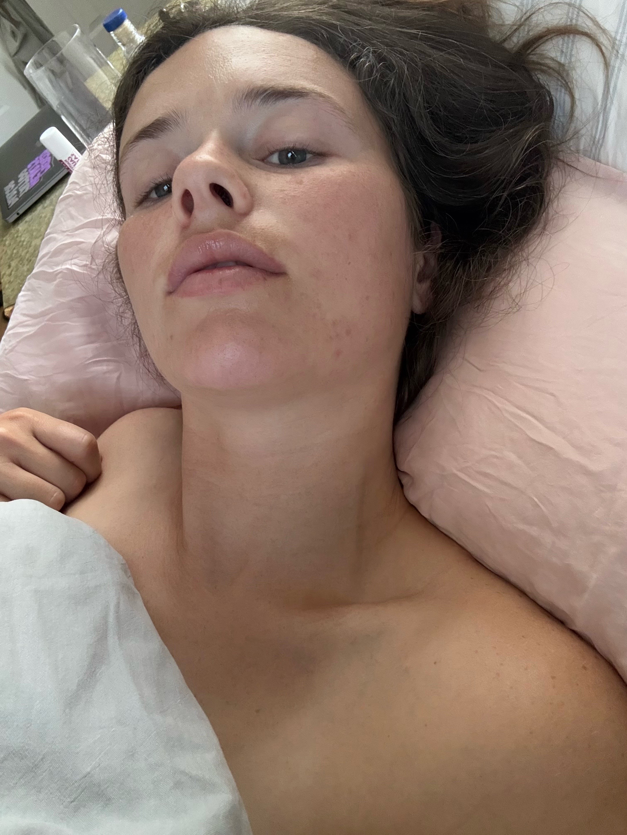 @Anna