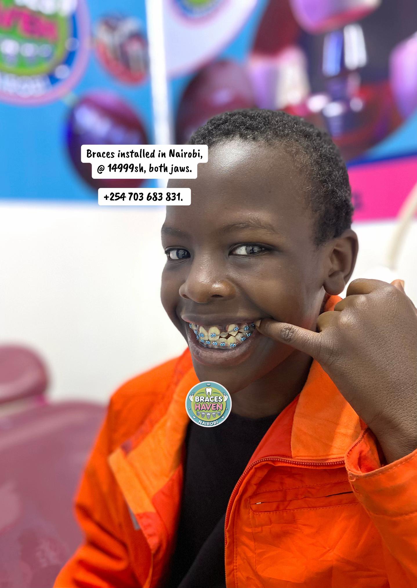 @Braces Haven Nairobi Dental